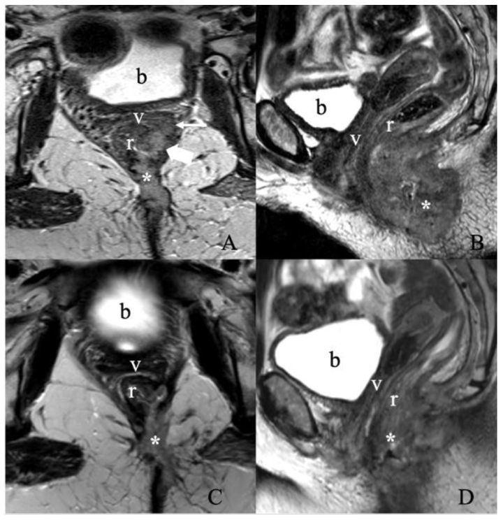 Cancers 14 02264 g011