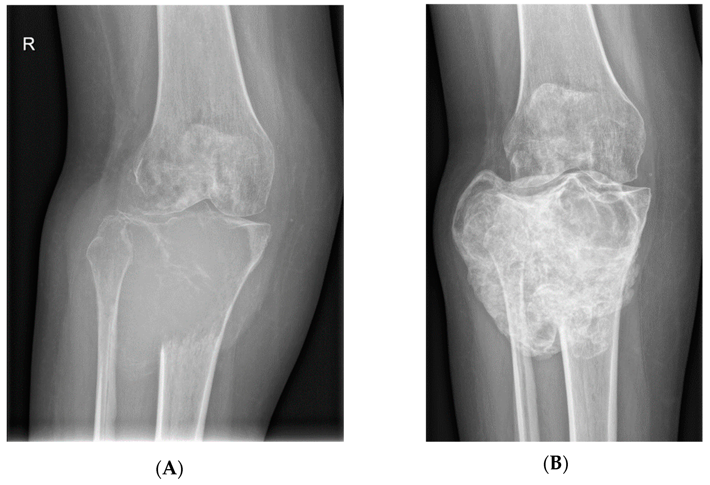 Cancers 14 02290 g004a