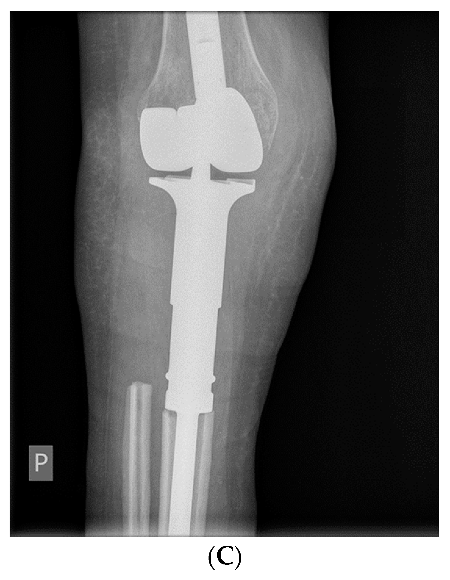 Cancers 14 02290 g004b