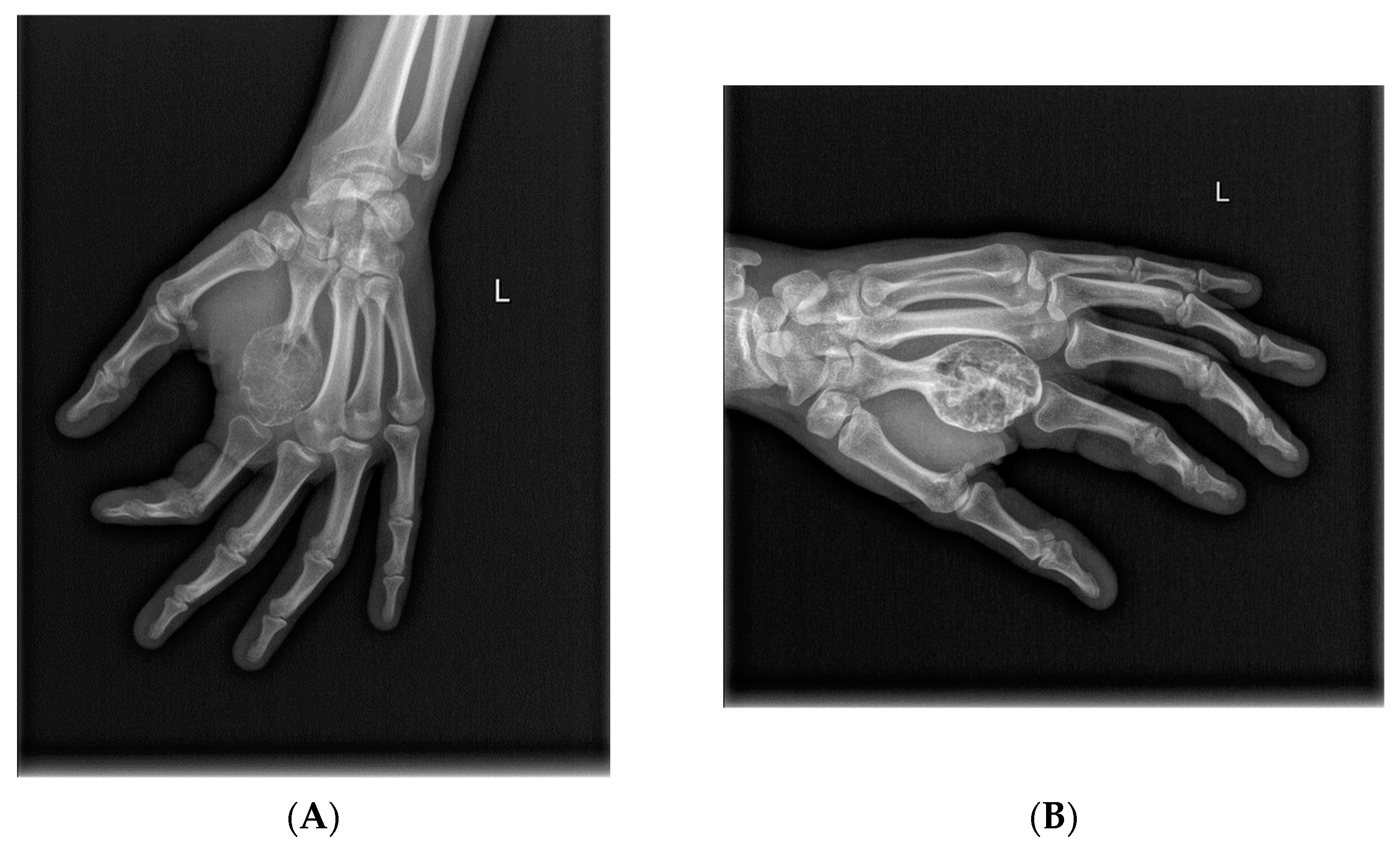 Cancers 14 02290 g005a