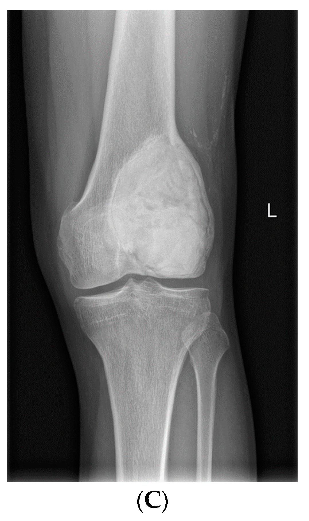 Cancers 14 02290 g006b