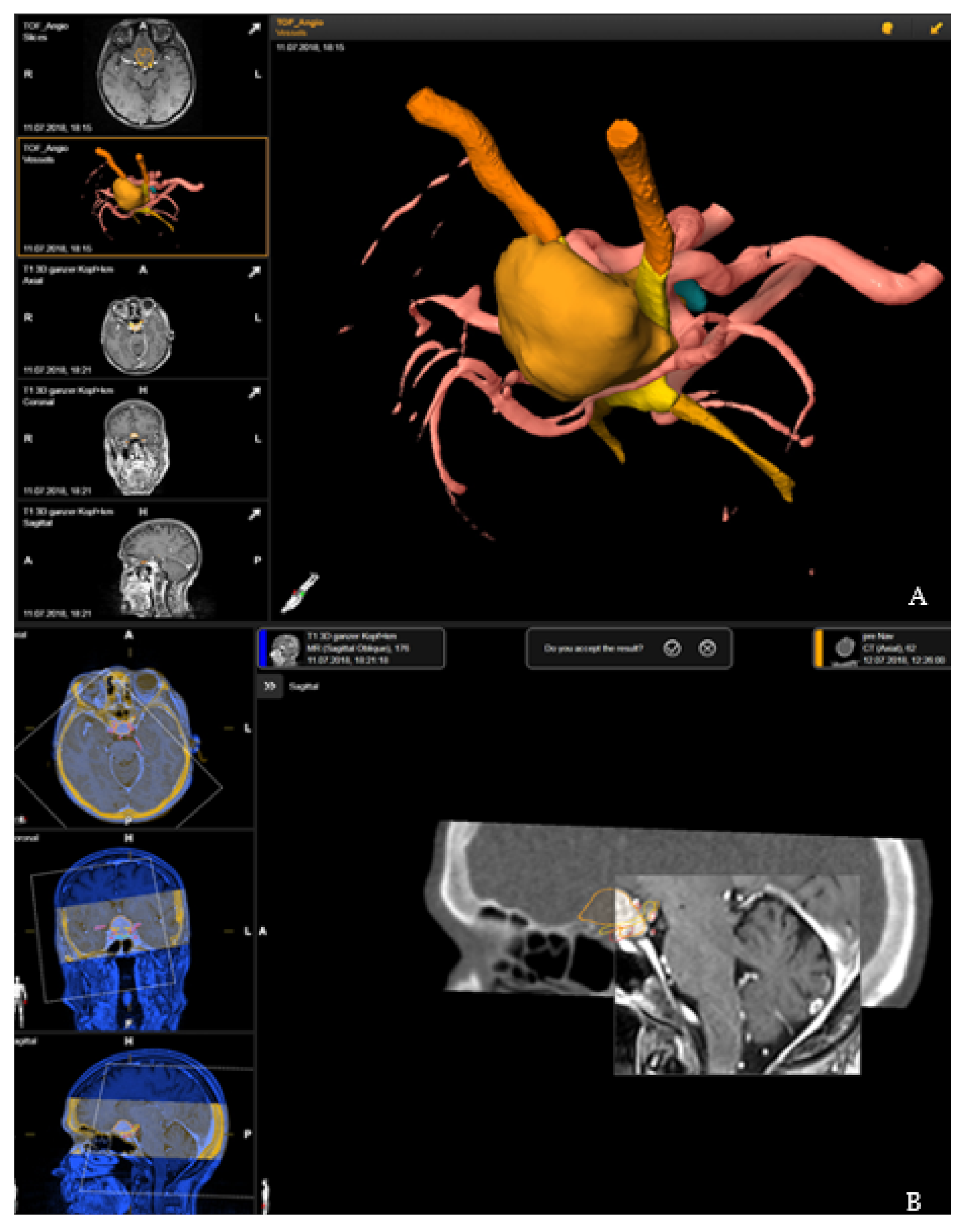 Cancers 14 02302 g001