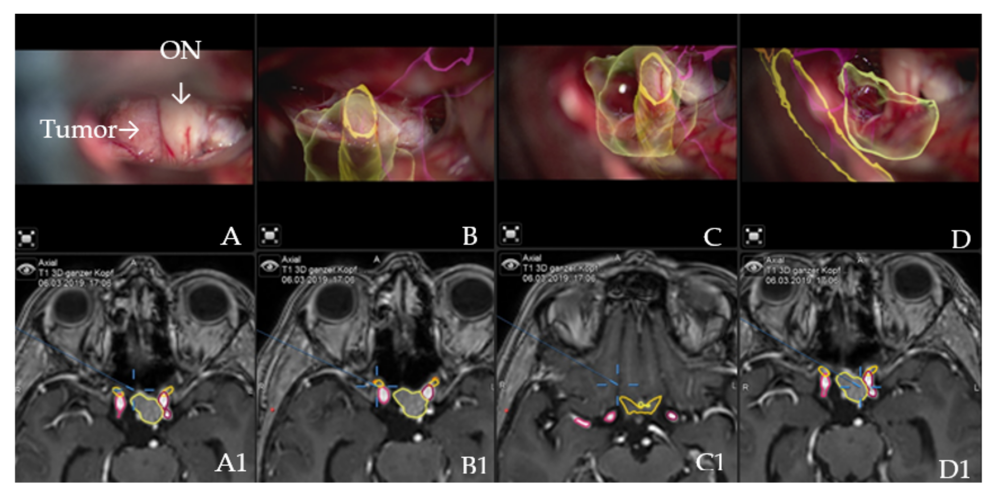 Cancers 14 02302 g002