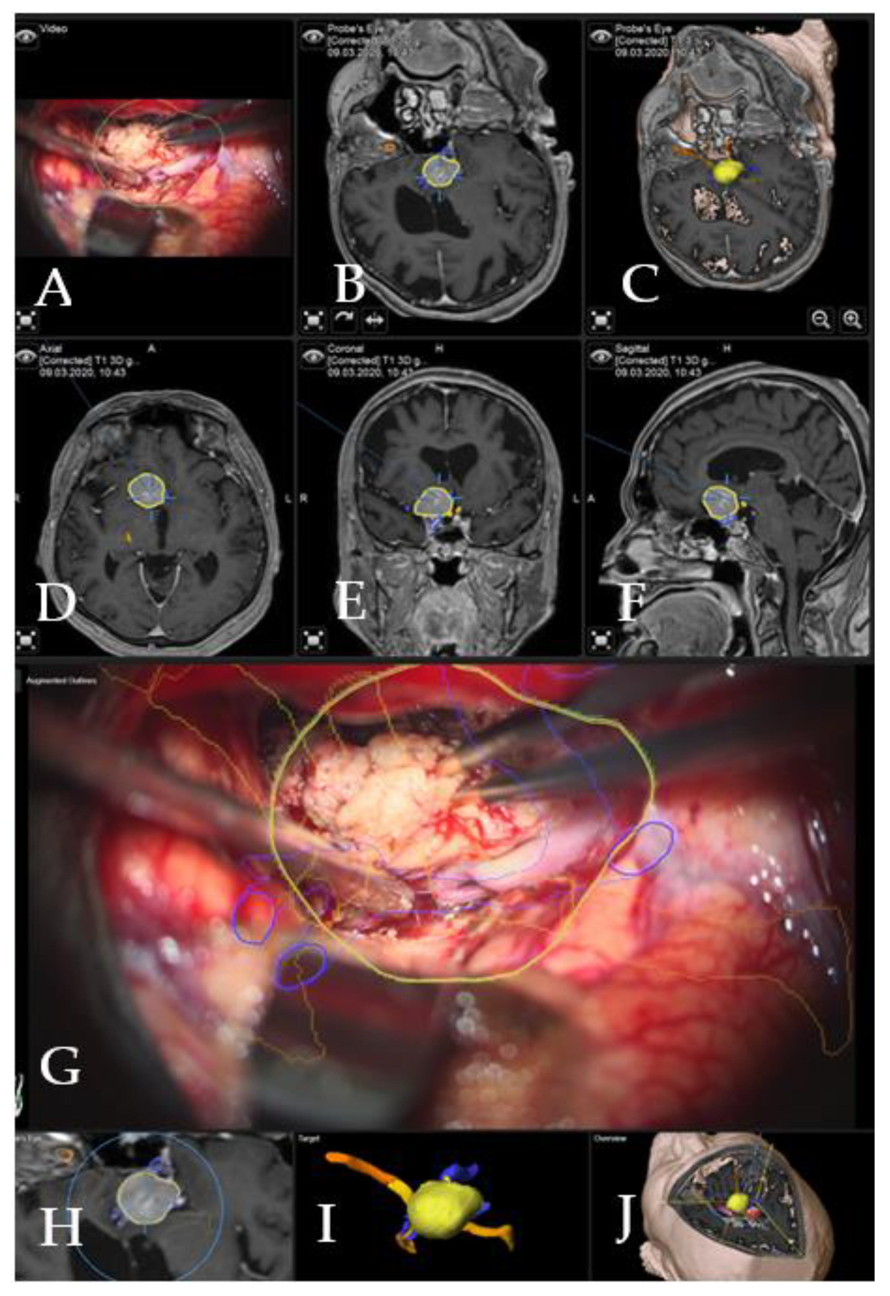 Cancers 14 02302 g003