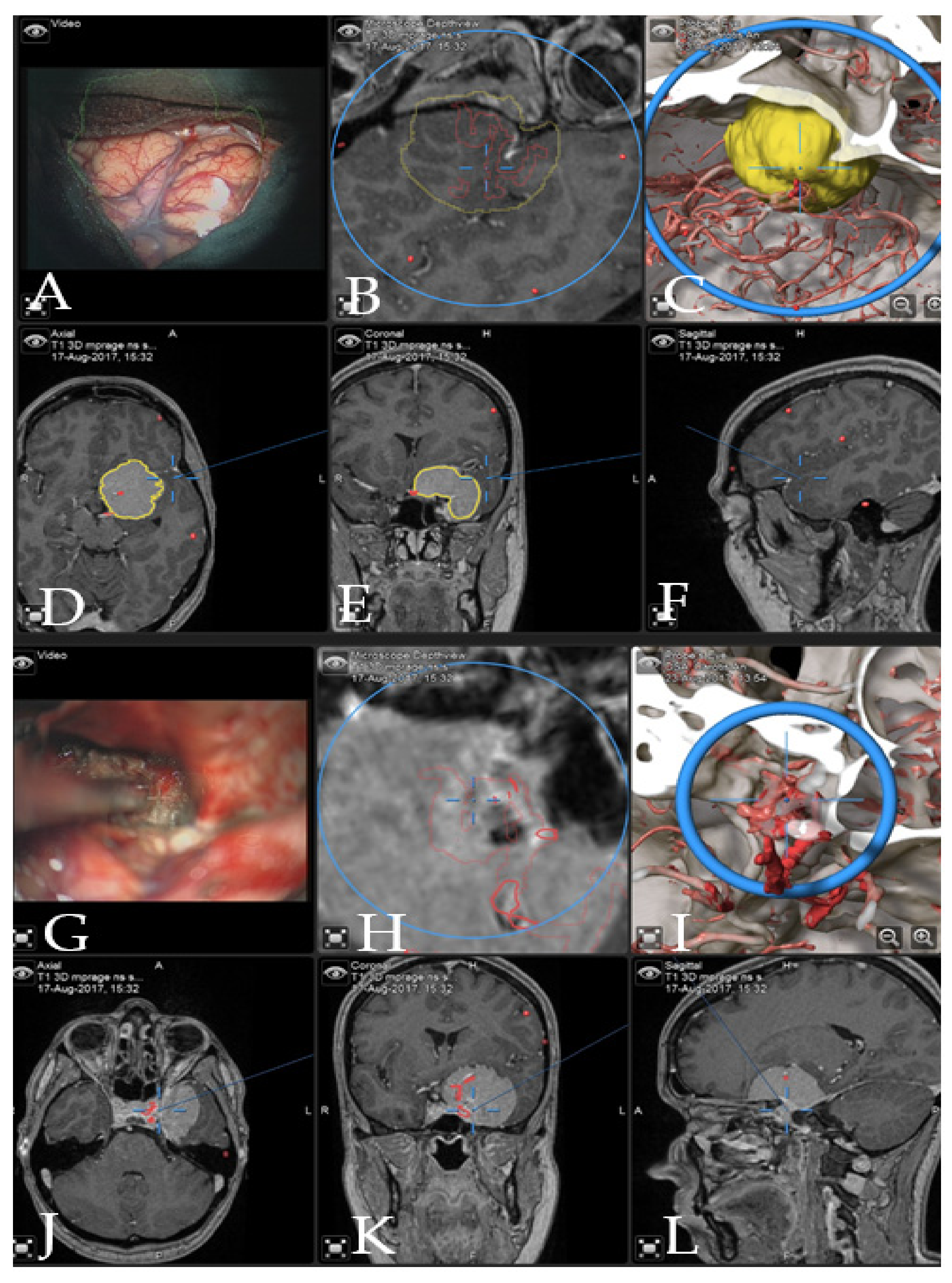 Cancers 14 02302 g005