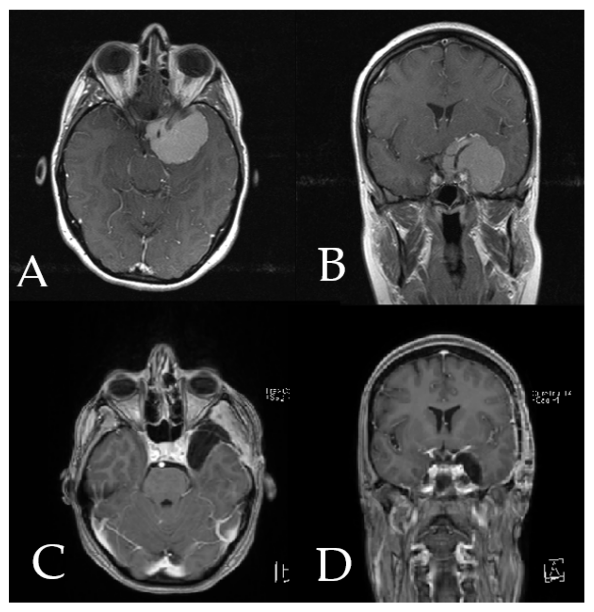 Cancers 14 02302 g006