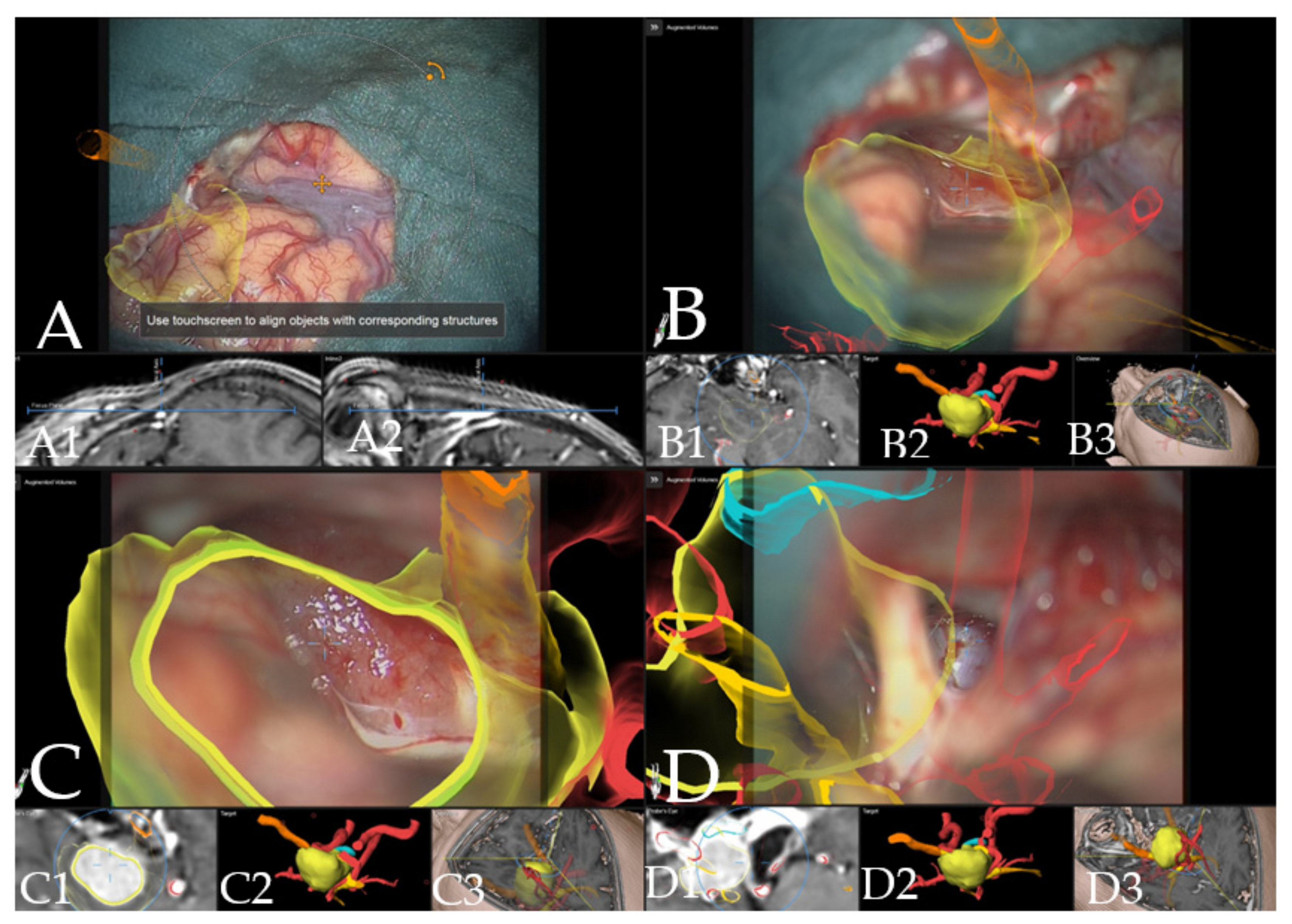 Cancers 14 02302 g007