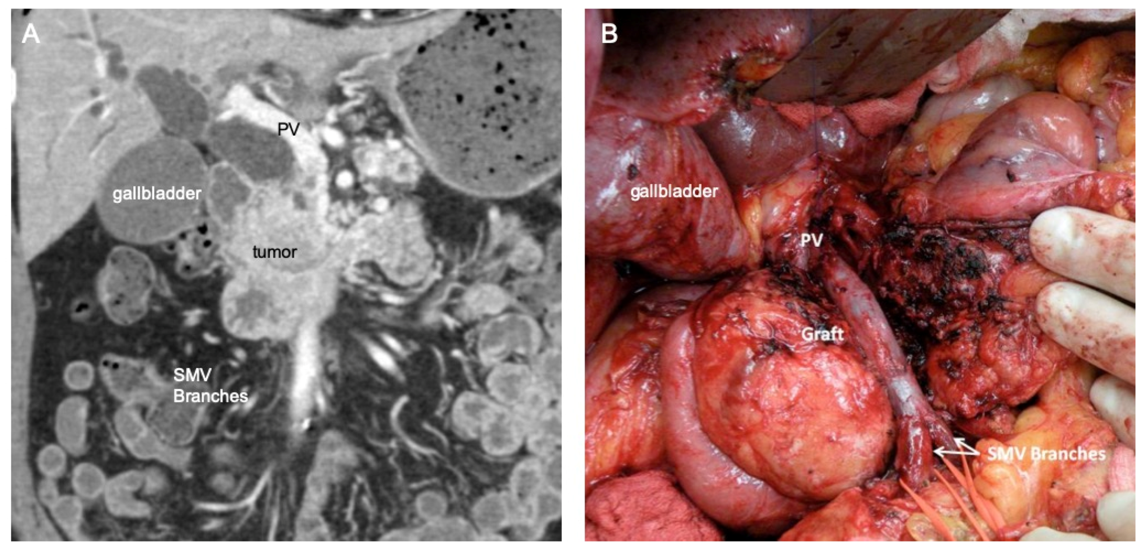 Cancers 14 02312 g001
