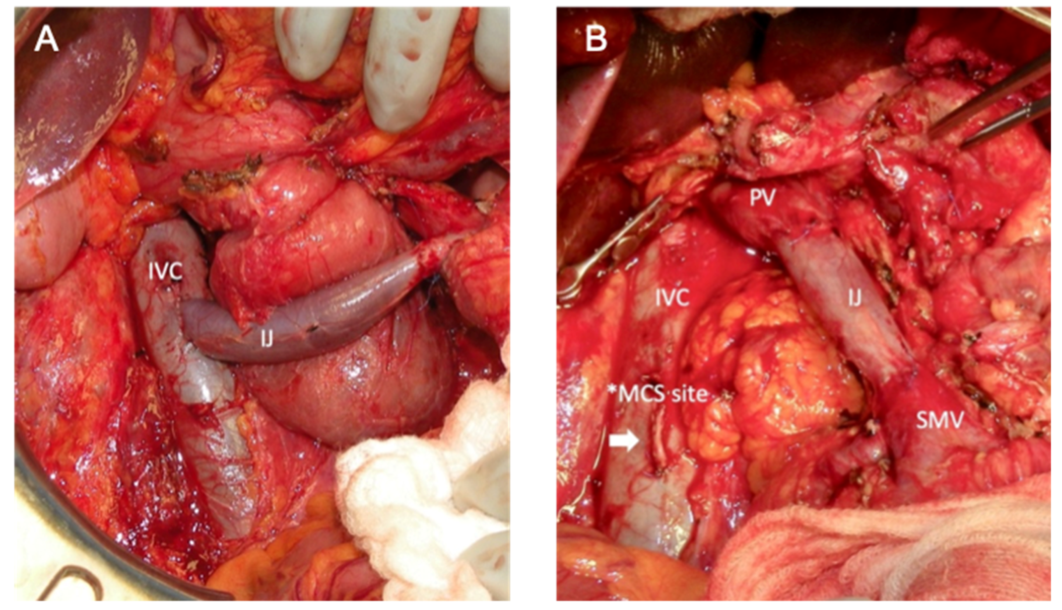 Cancers 14 02312 g003
