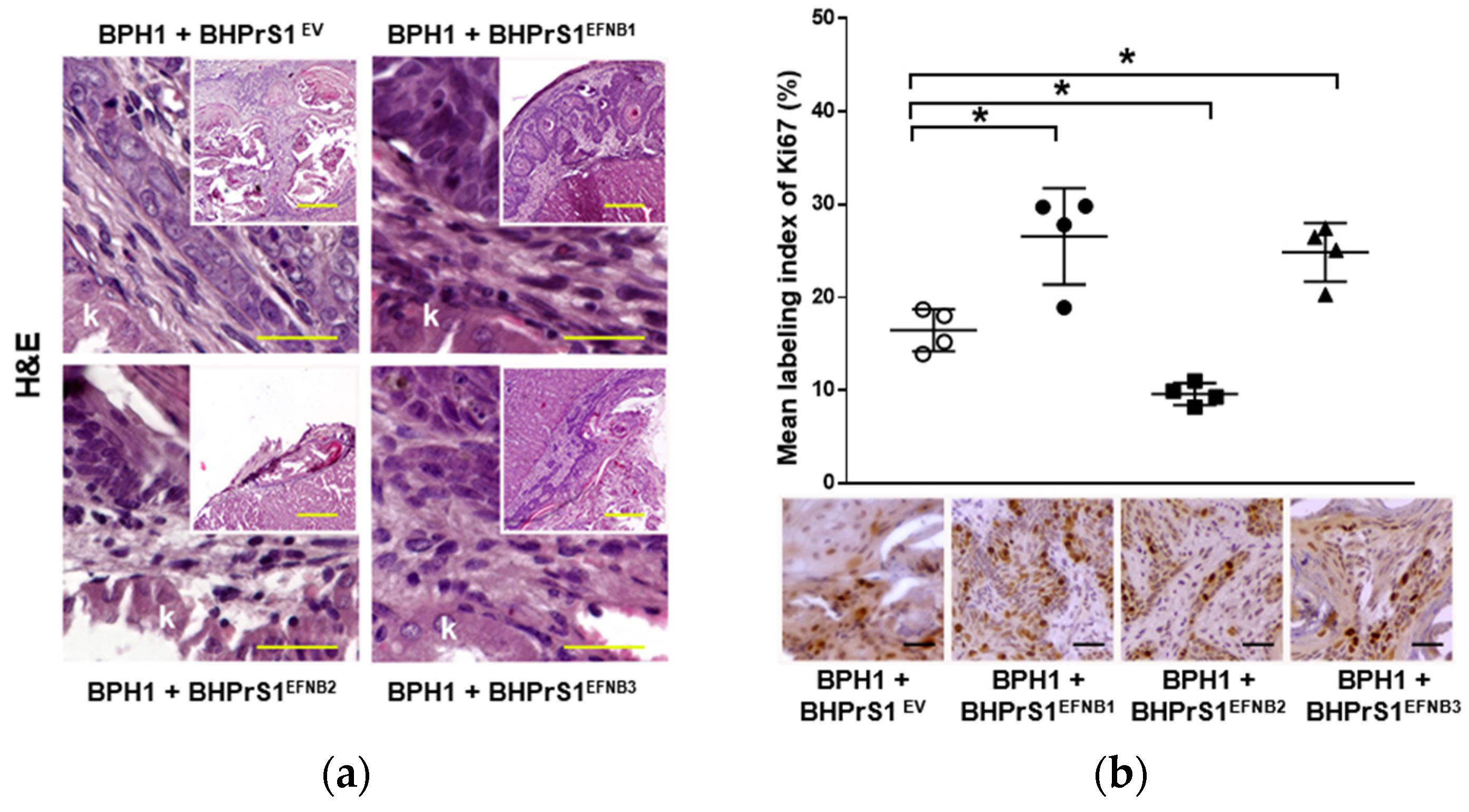 Cancers 14 02336 g005a