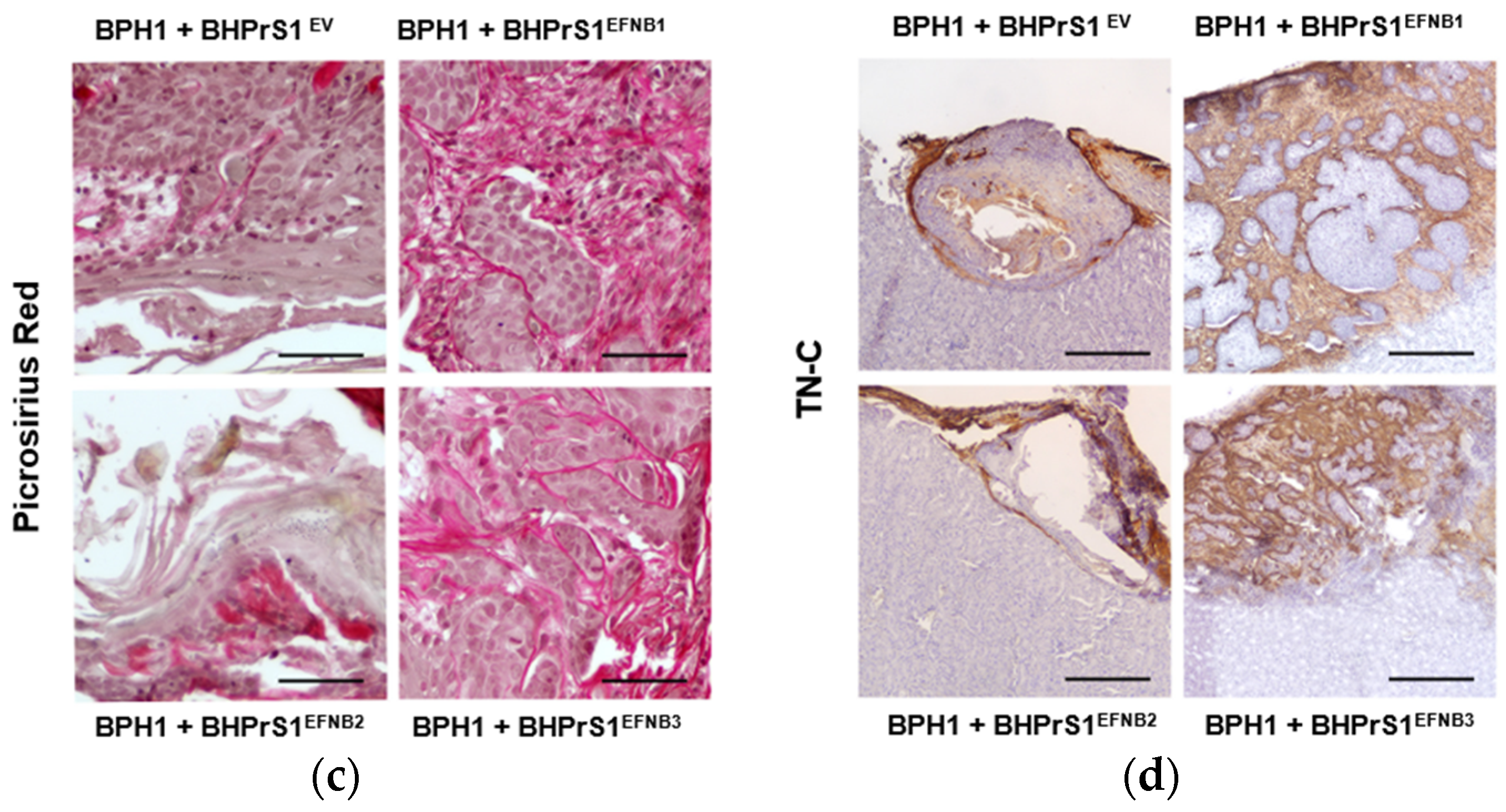 Cancers 14 02336 g005b