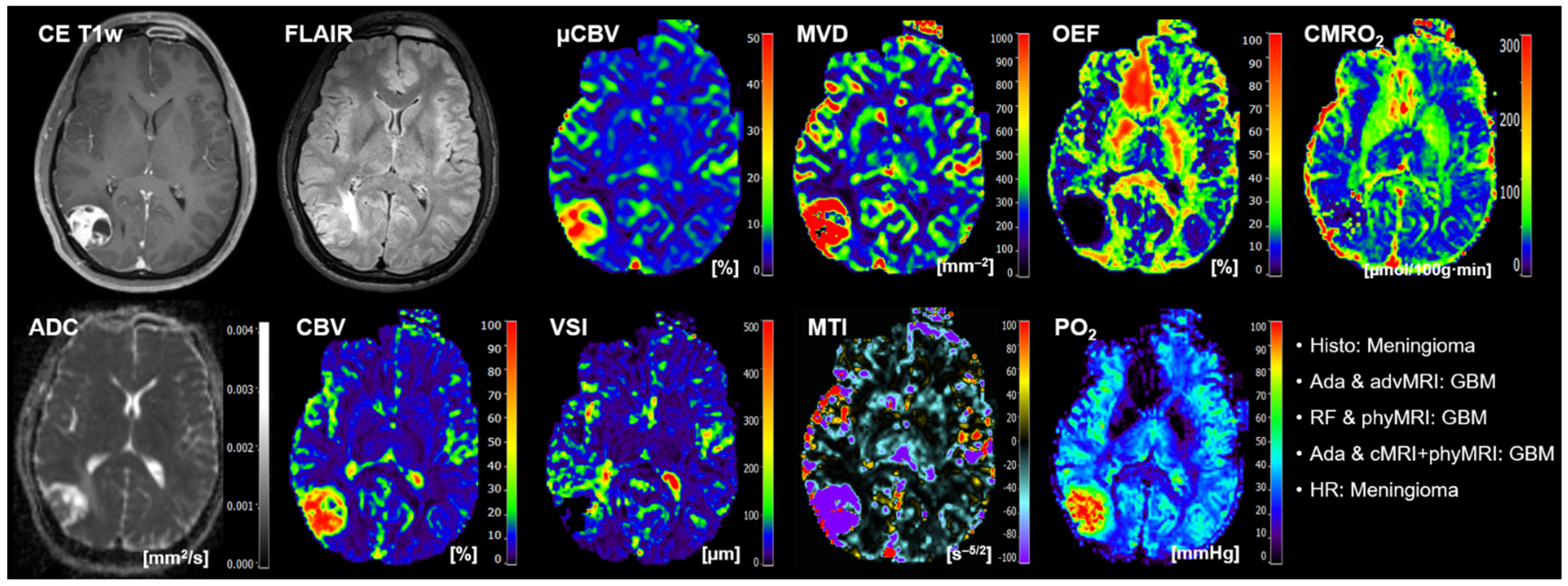 Cancers 14 02363 g004