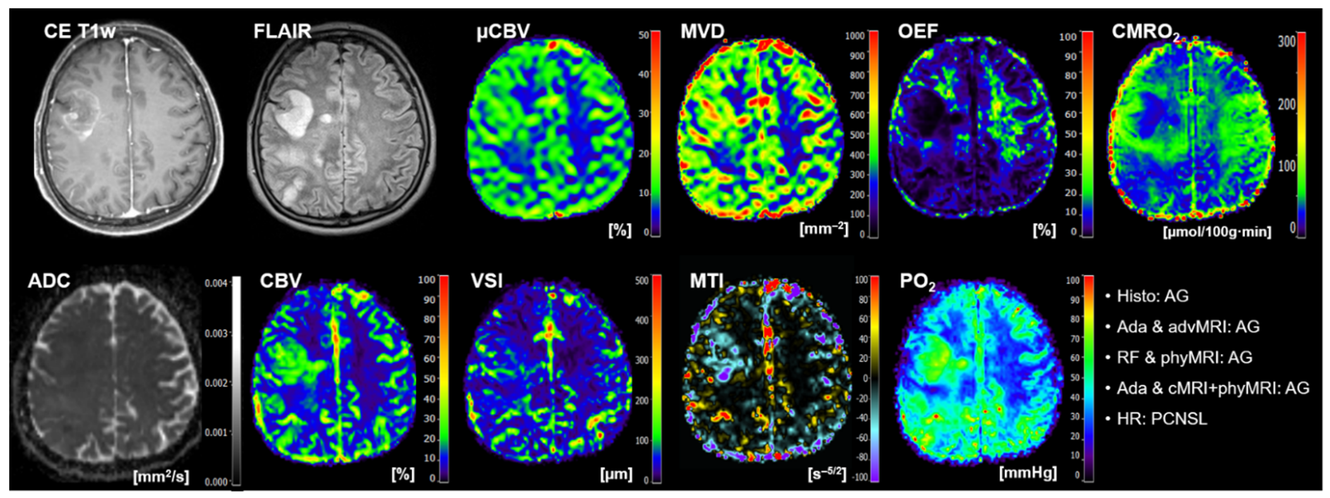 Cancers 14 02363 g005