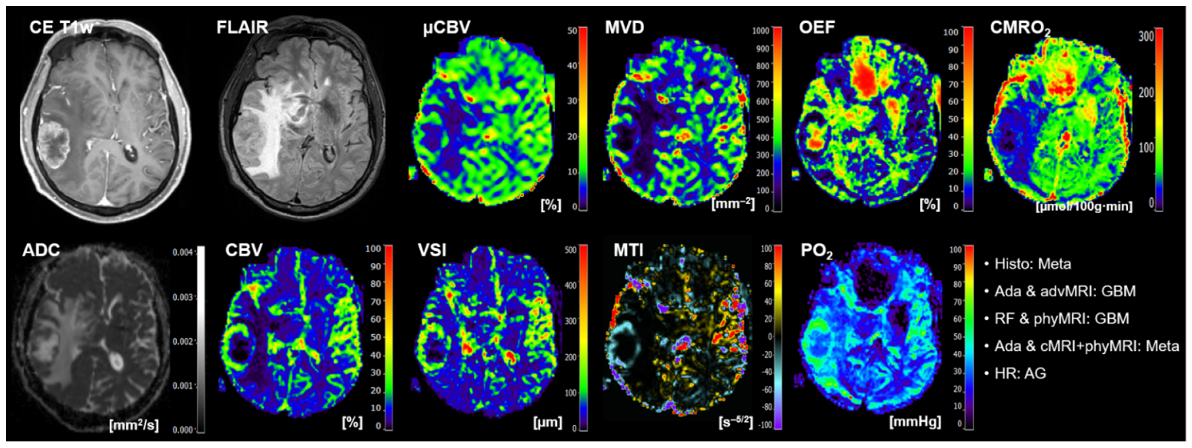Cancers 14 02363 g006