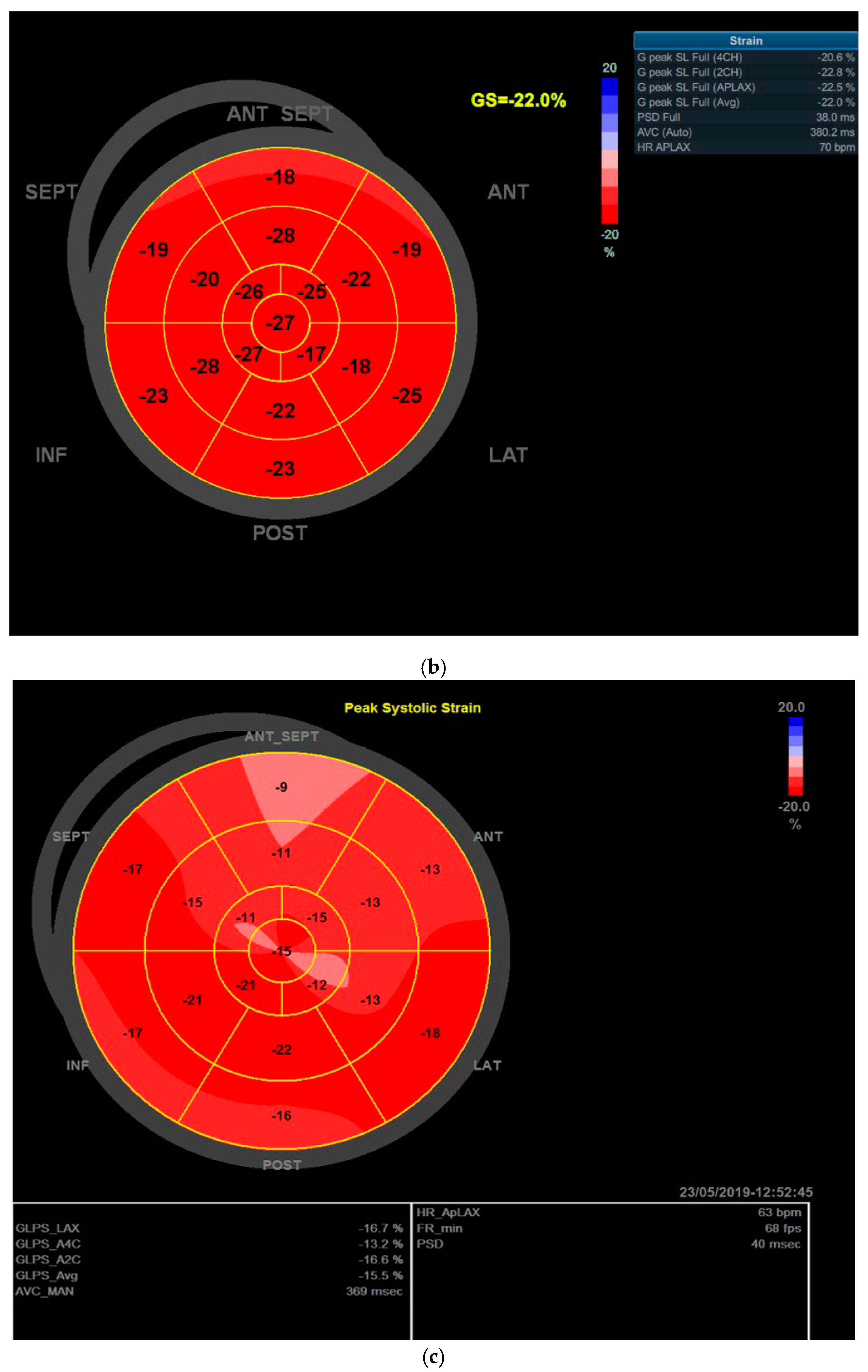 Cancers 14 02420 g001b