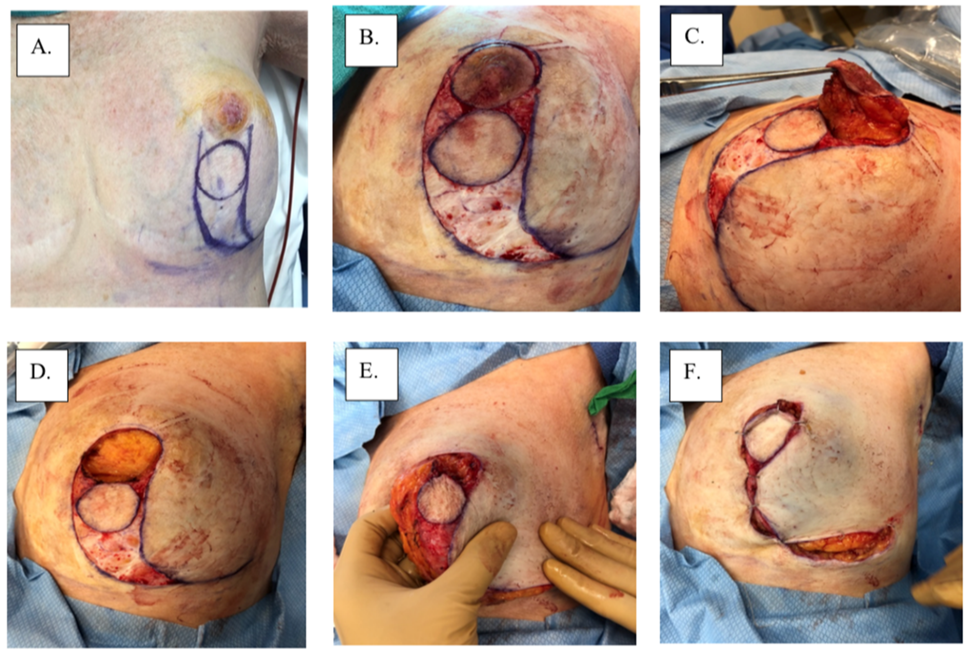 Cancers 14 02422 g004a