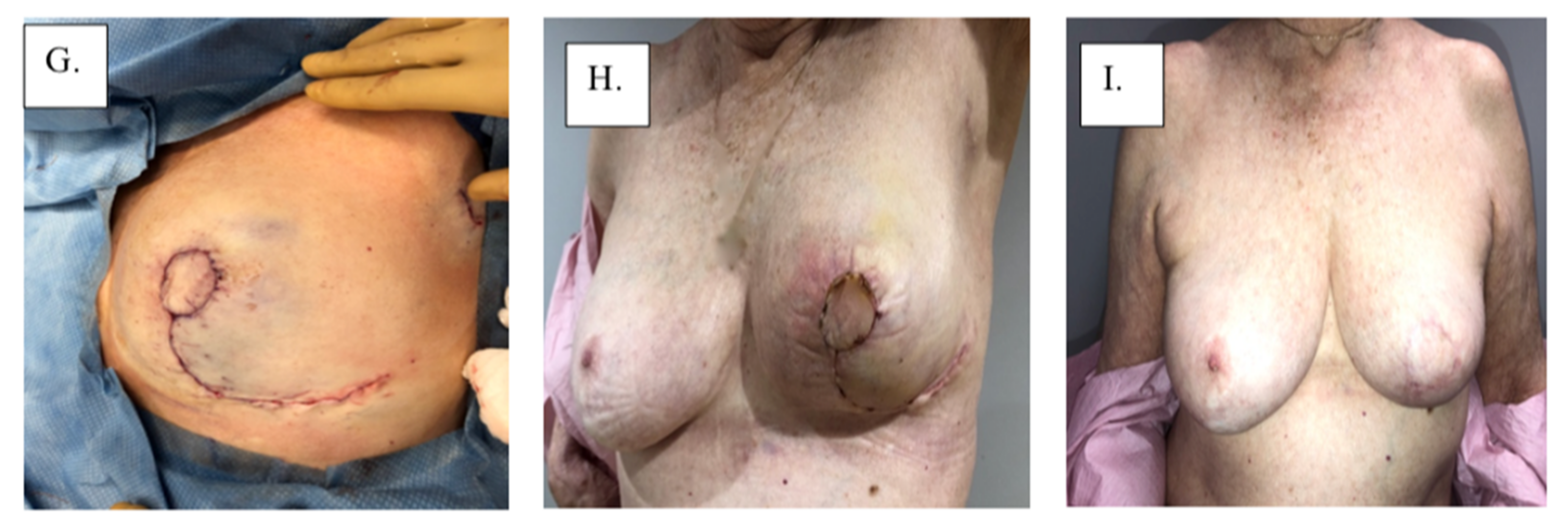 Cancers 14 02422 g004b