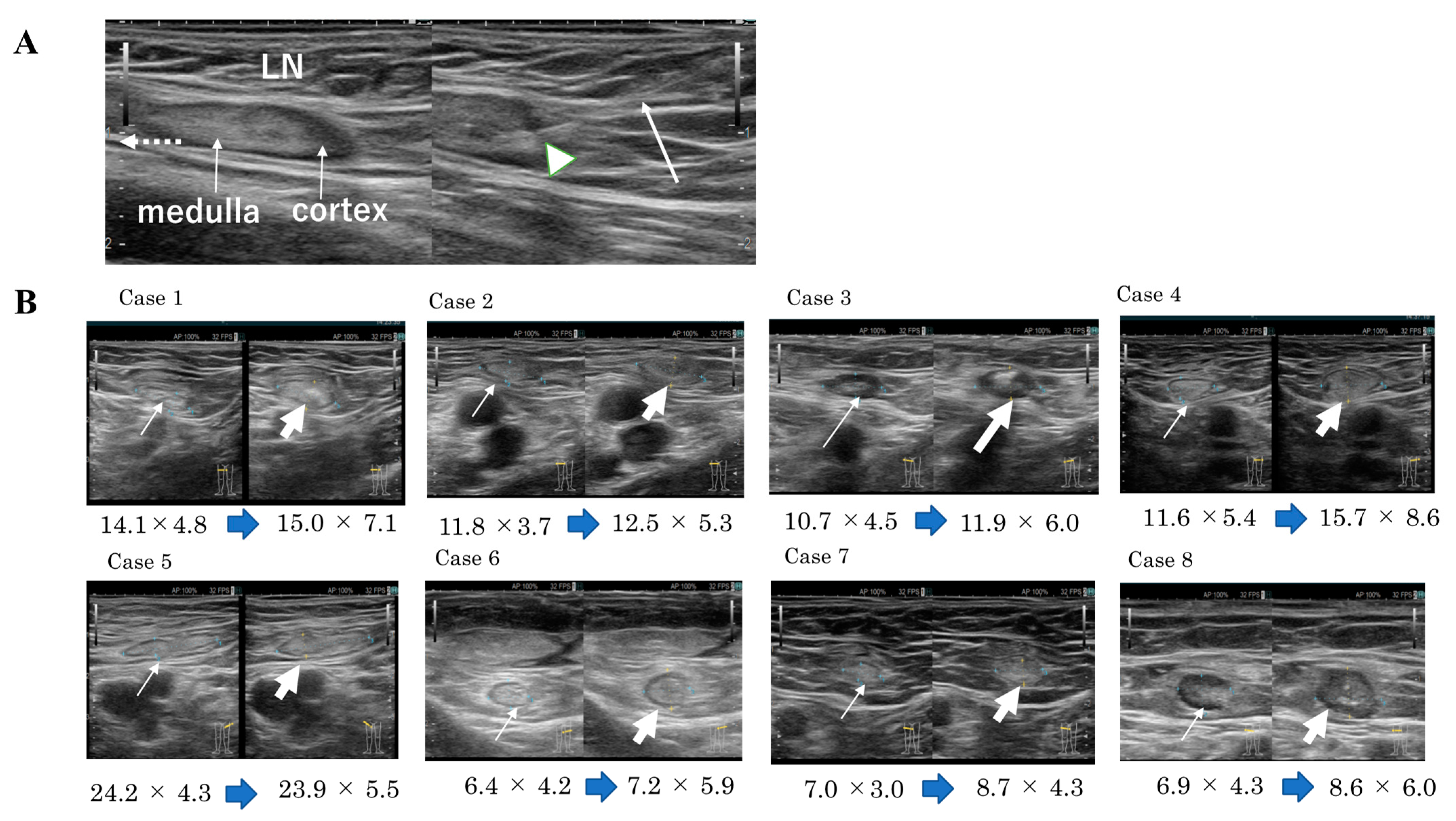 Cancers 14 02438 g003