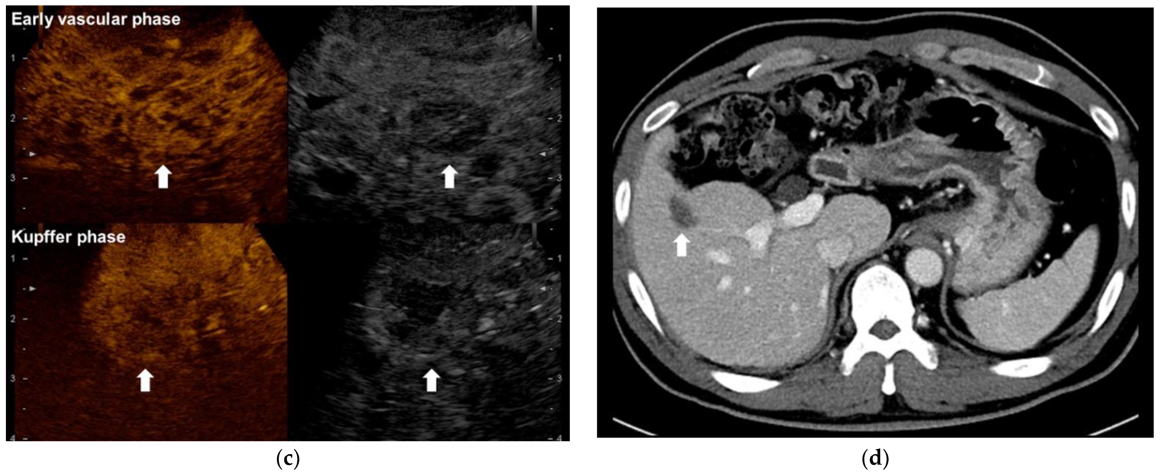 Cancers 14 02440 g003b