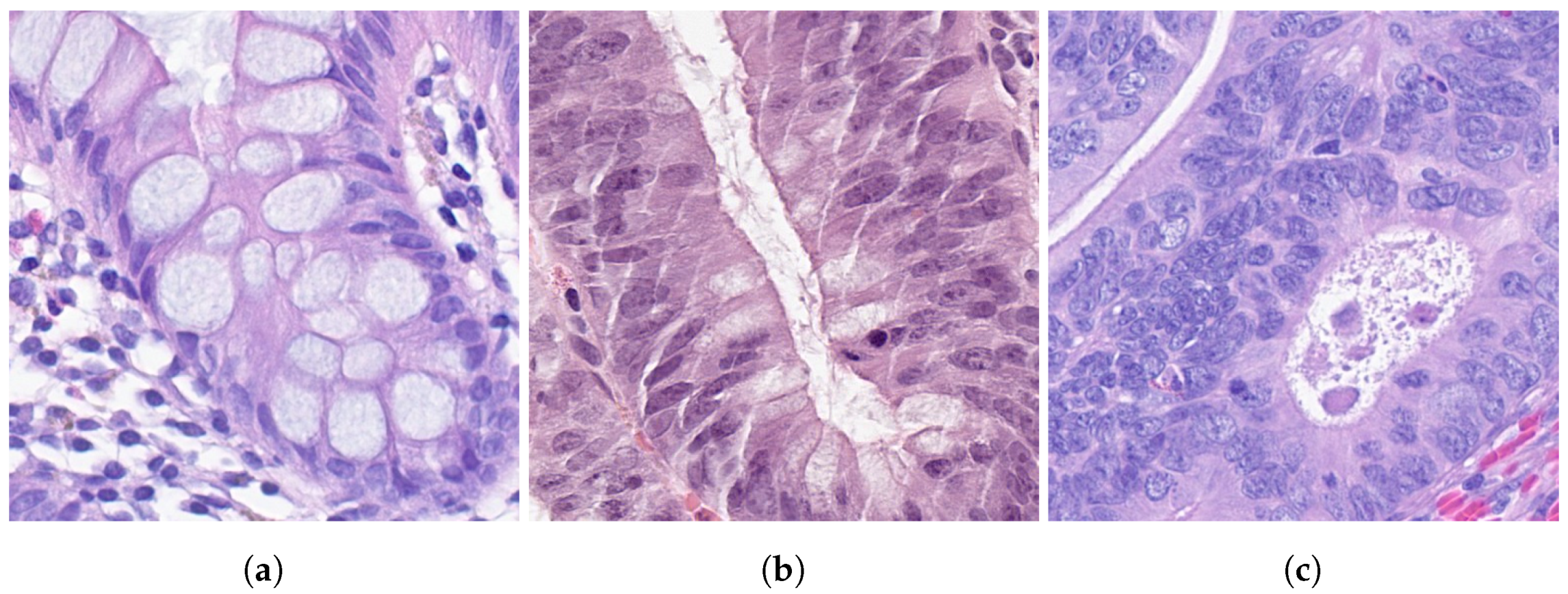 Cancers 14 02489 g001