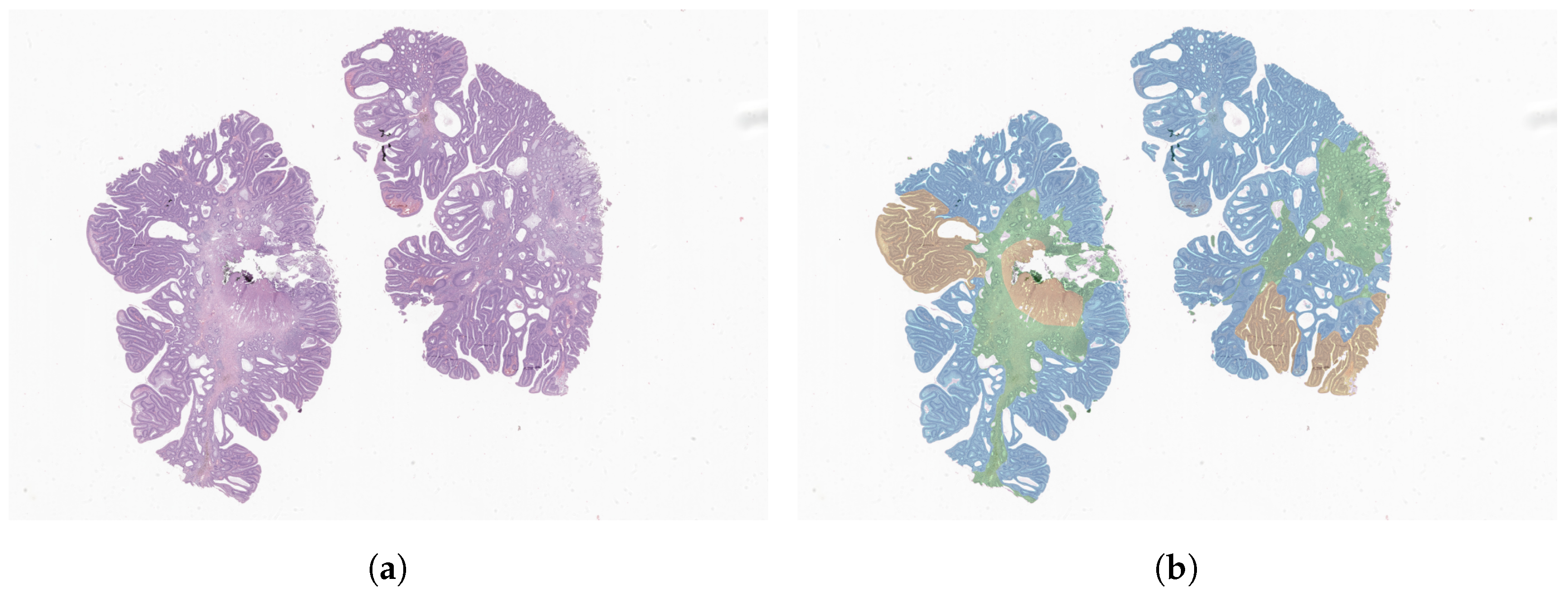 Cancers 14 02489 g004