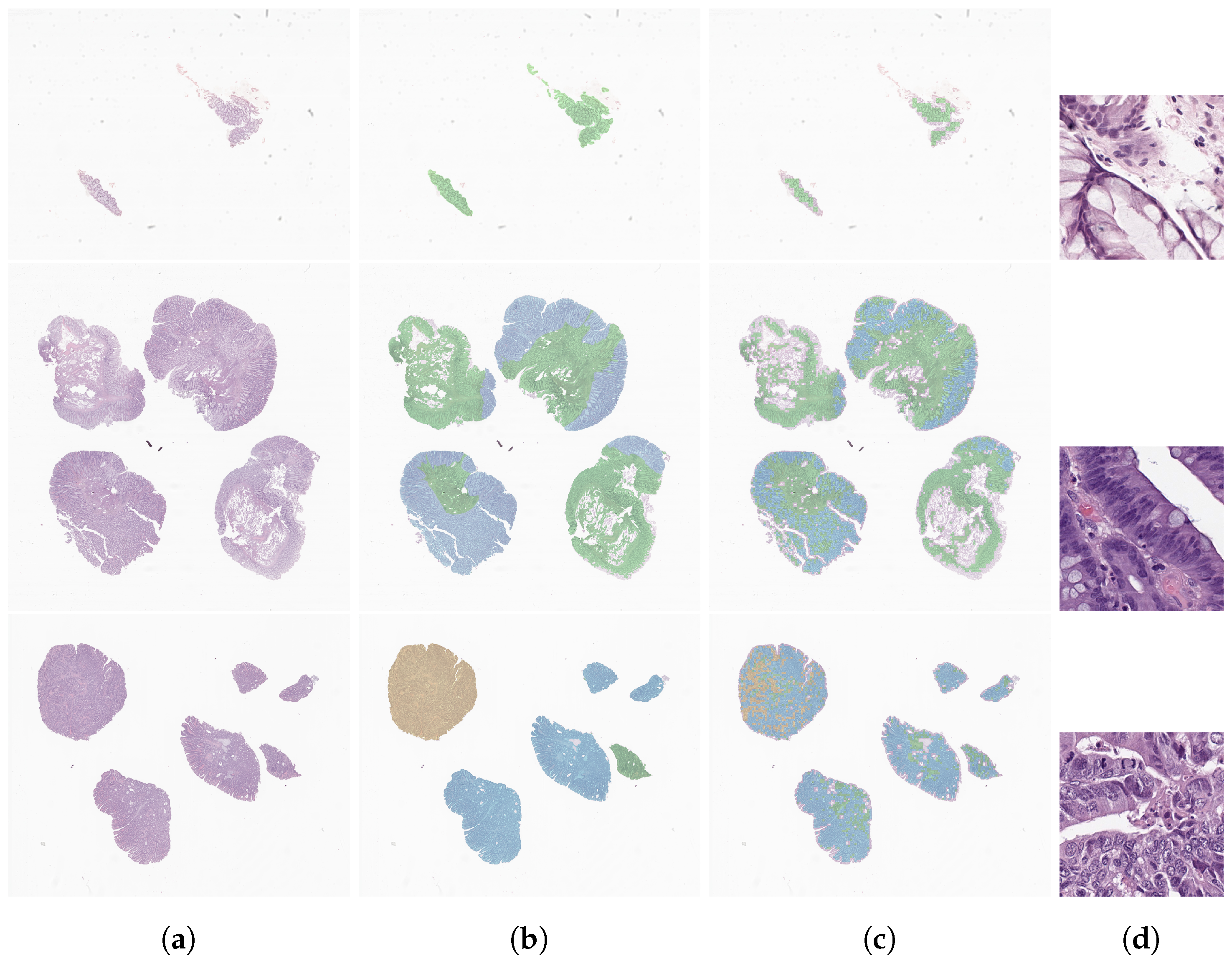 Cancers 14 02489 g006