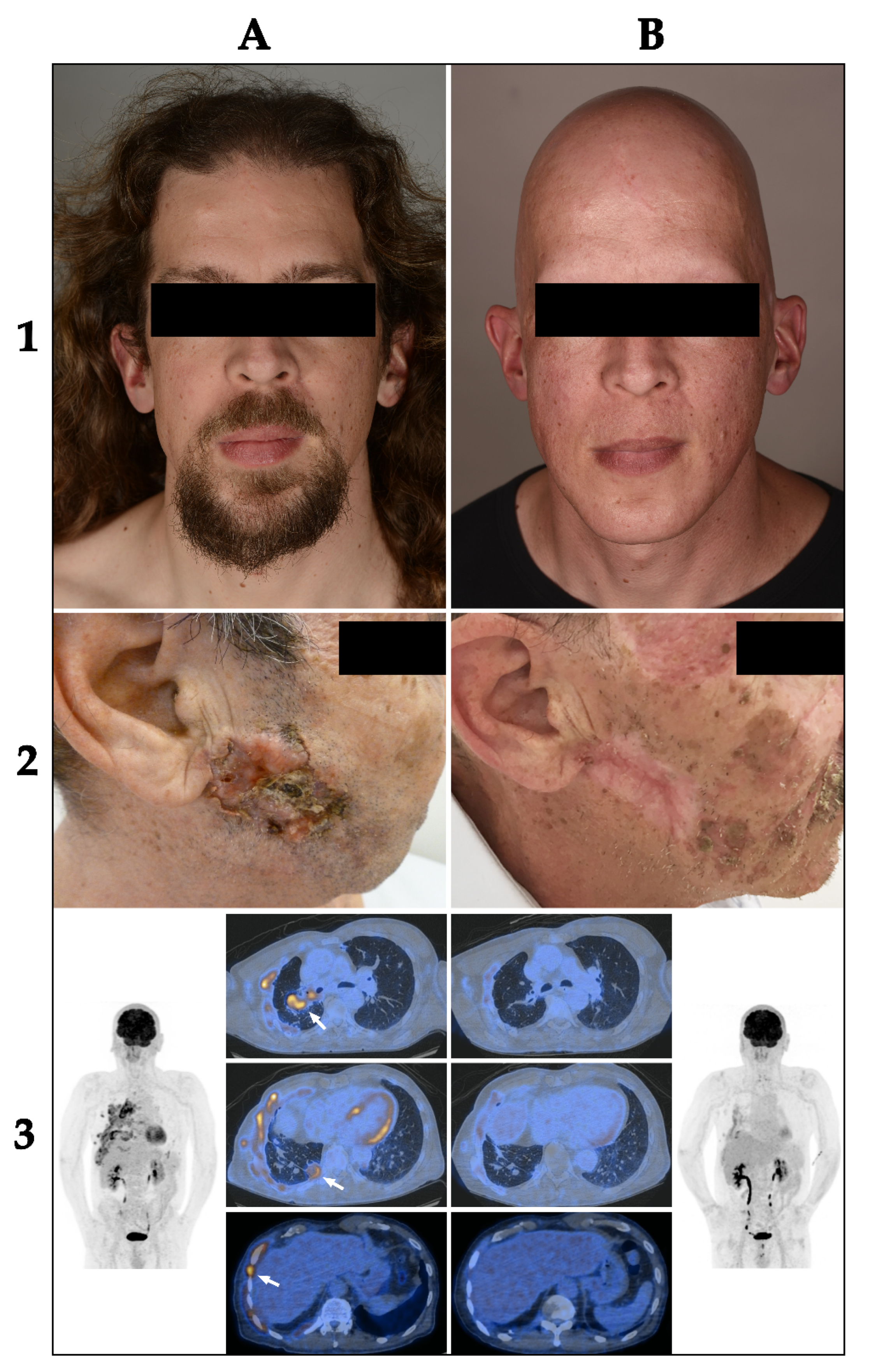 Cancers 14 02496 g003