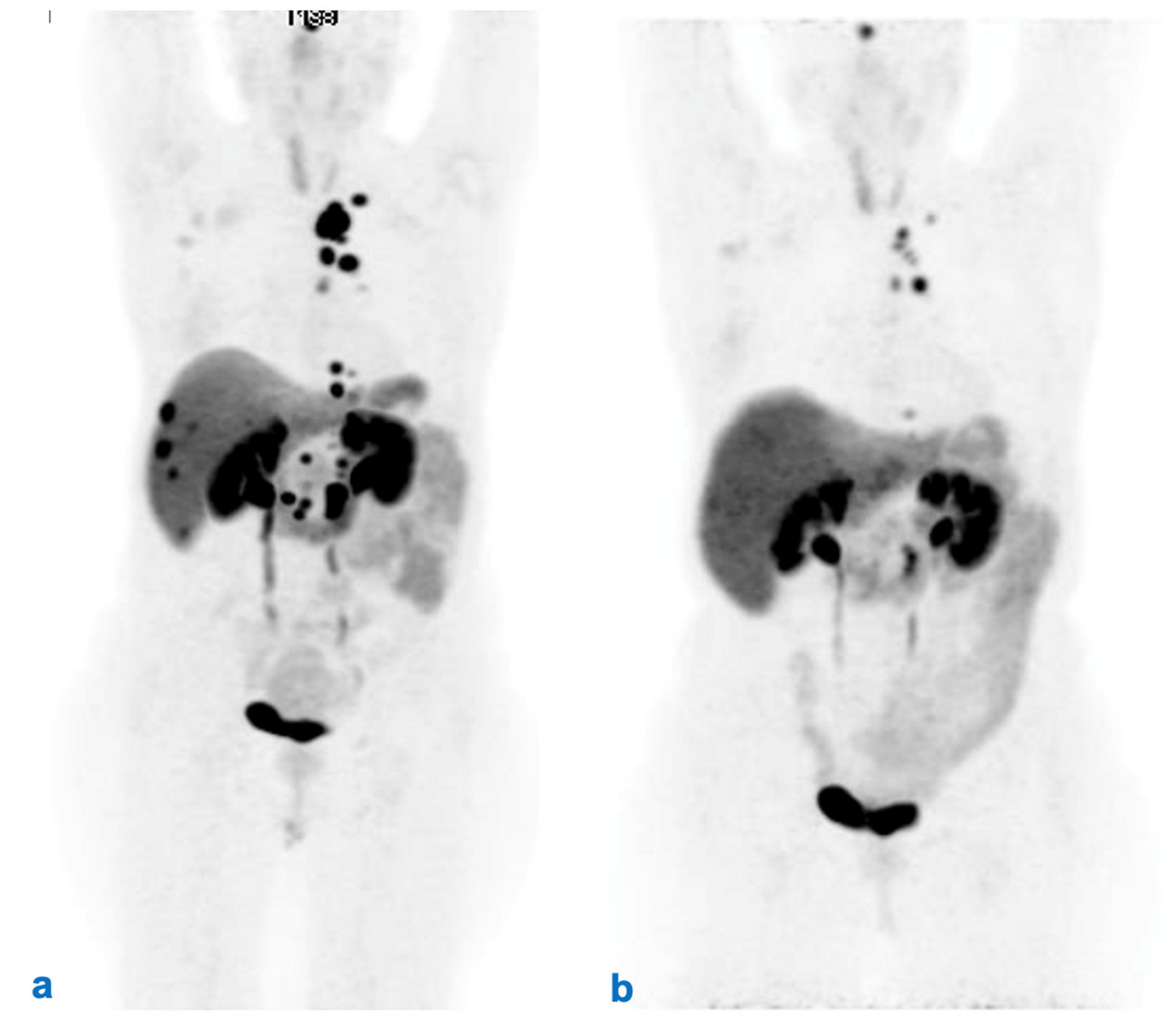 Cancers 14 02501 g003