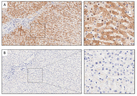 Cancers 14 02543 g0a5 550