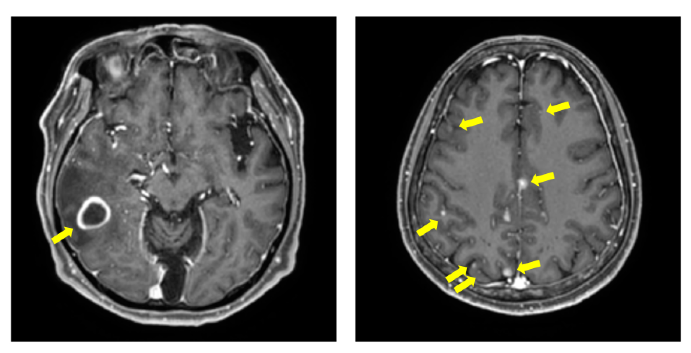 Cancers 14 02555 g001