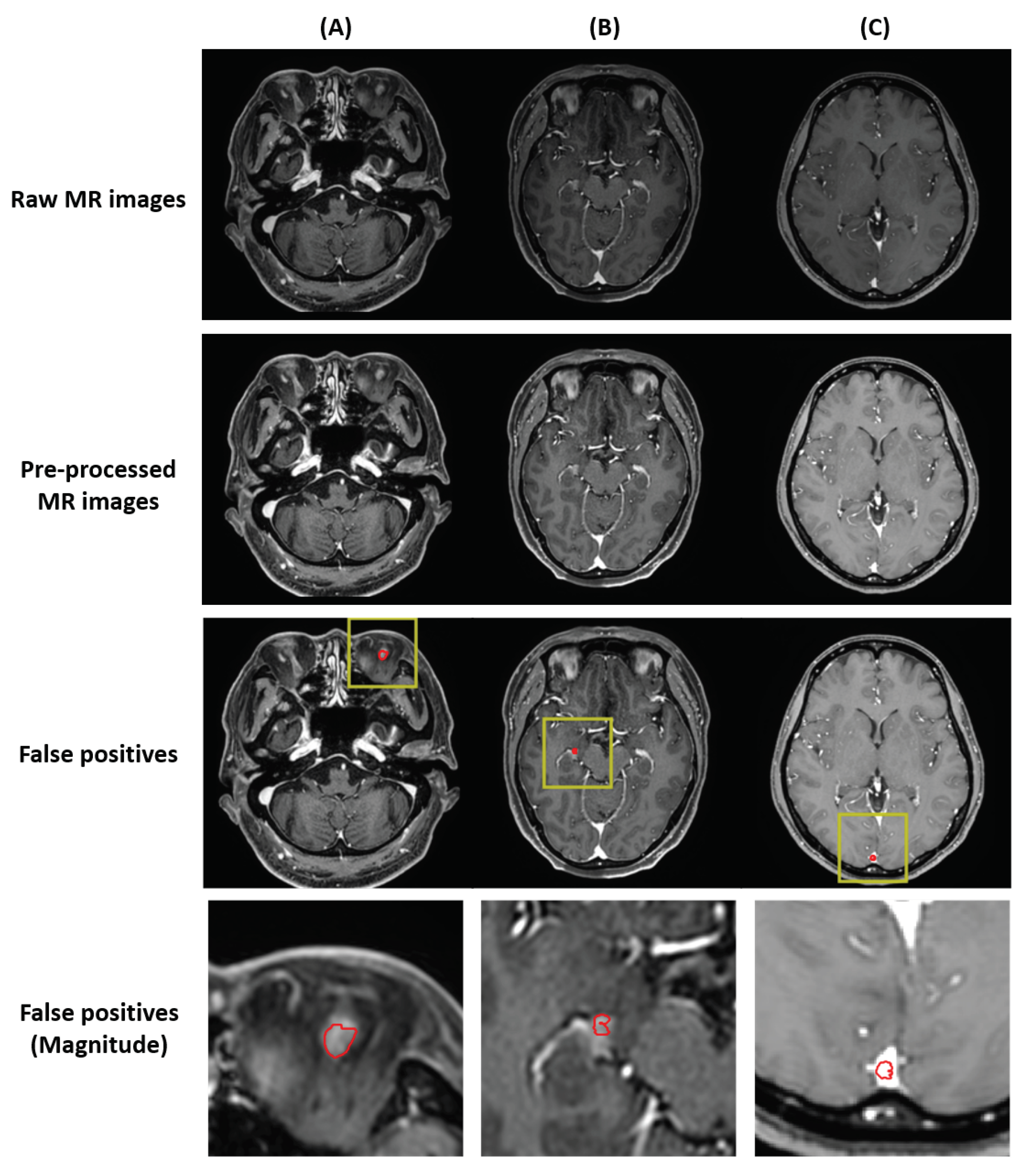 Cancers 14 02555 g004