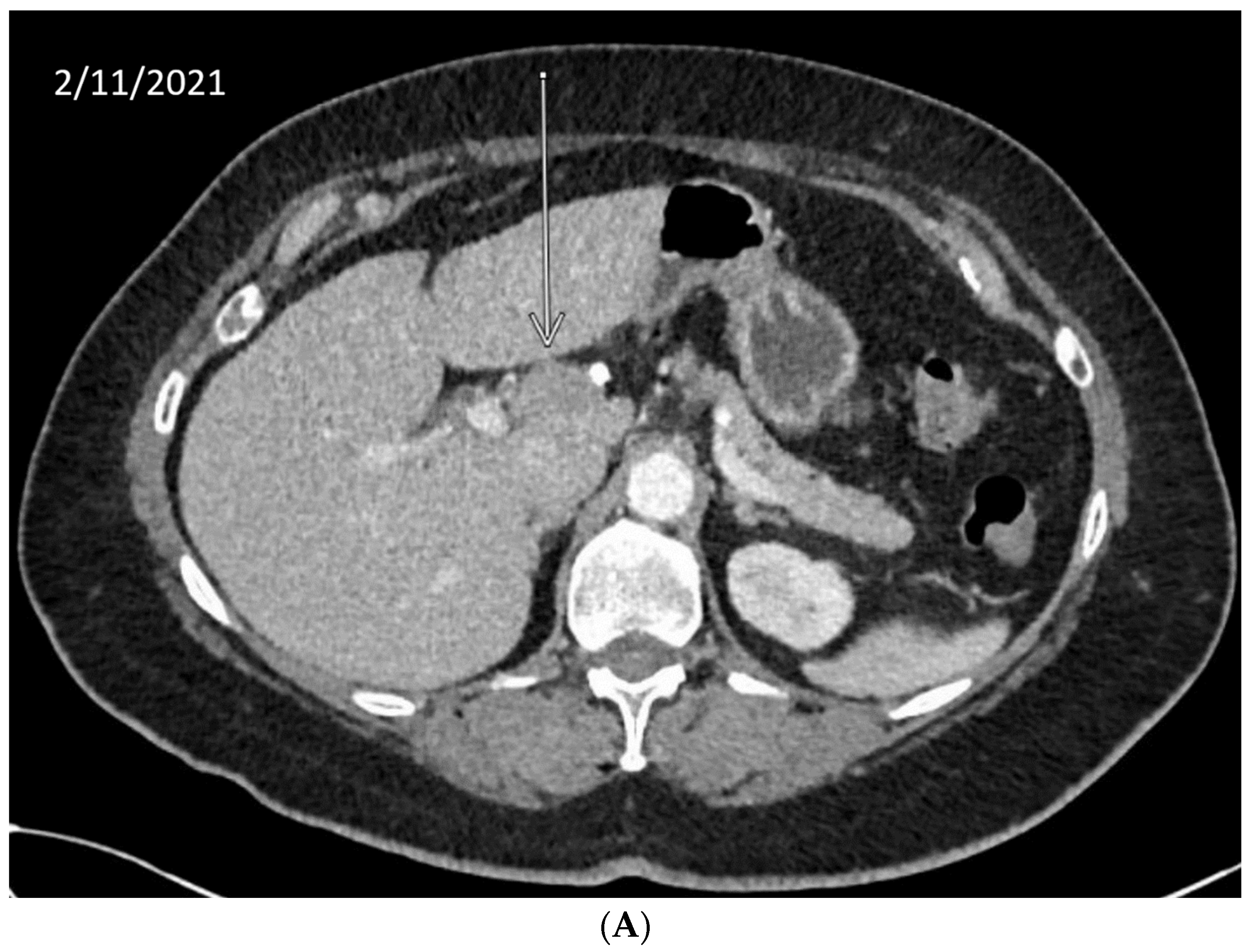 Cancers 14 02561 g002a