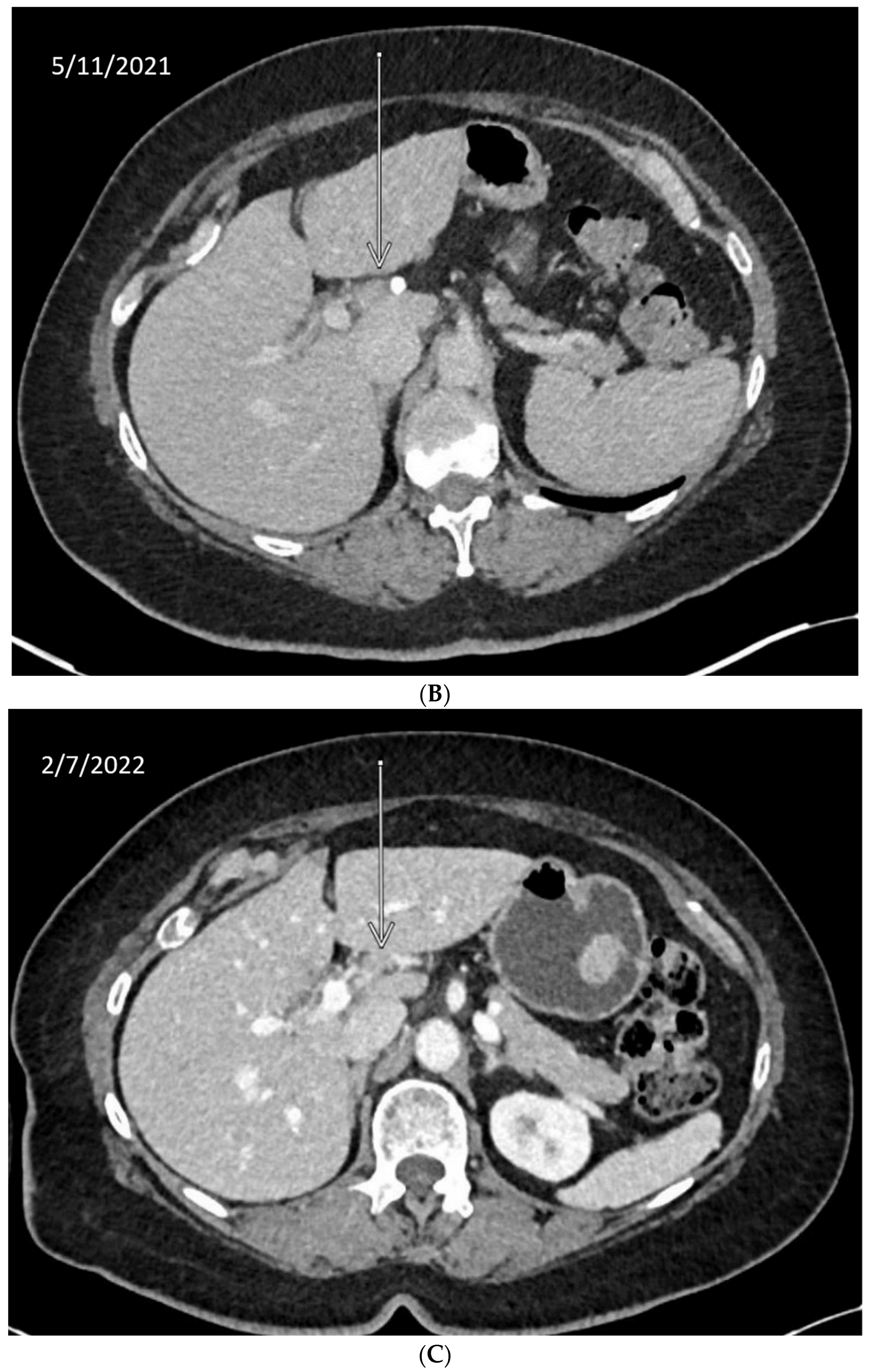 Cancers 14 02561 g002b