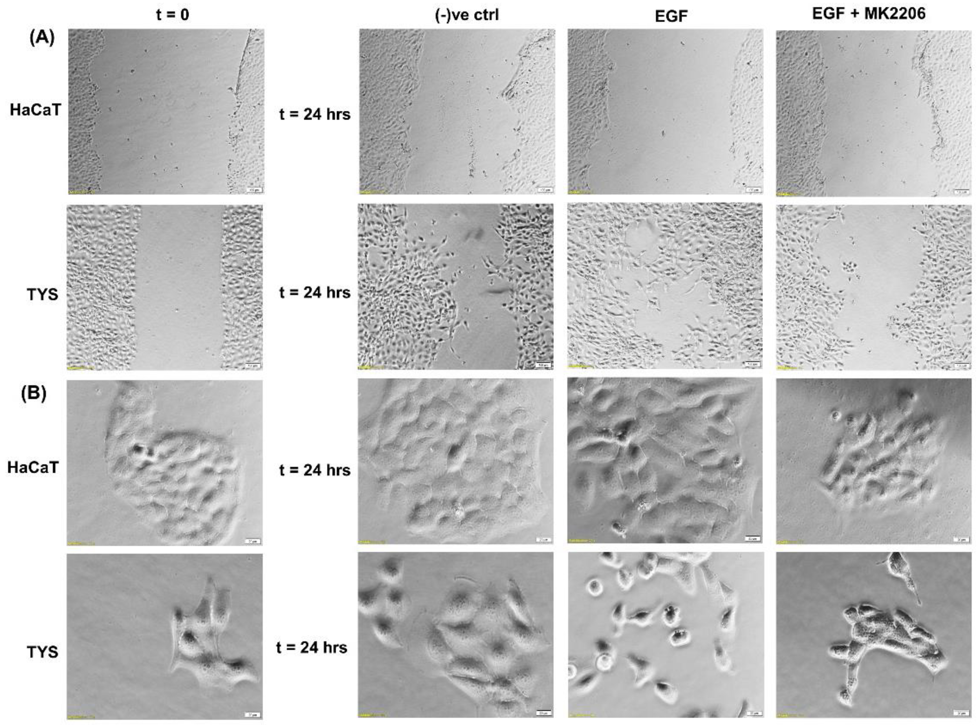 Cancers 14 02606 g003