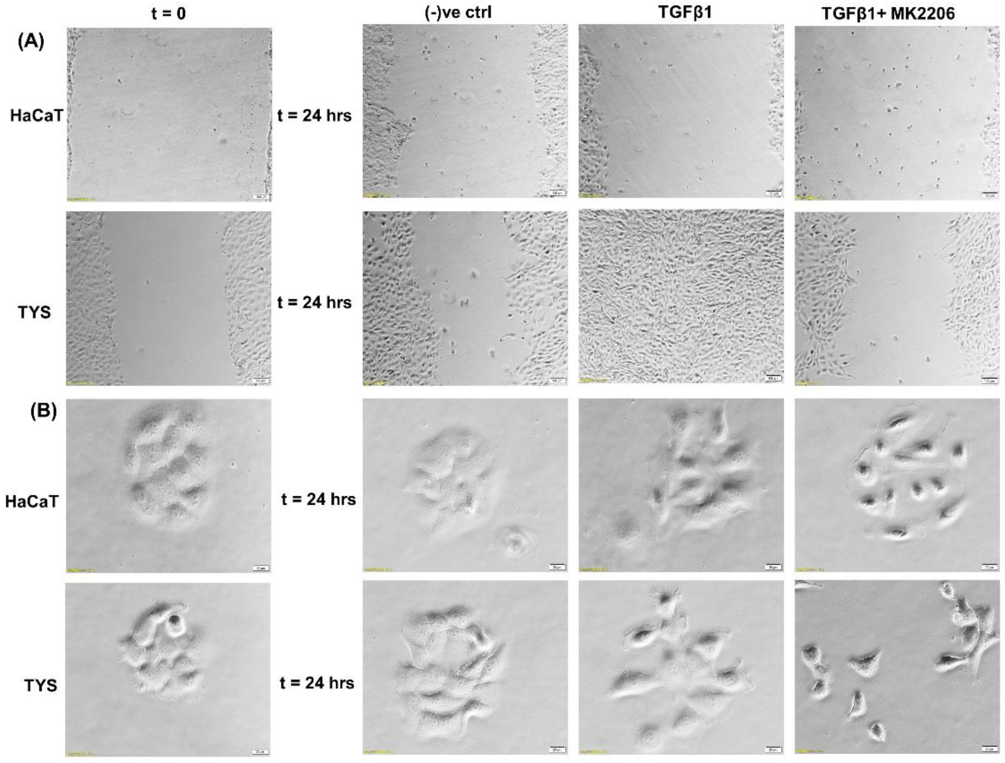 Cancers 14 02606 g005