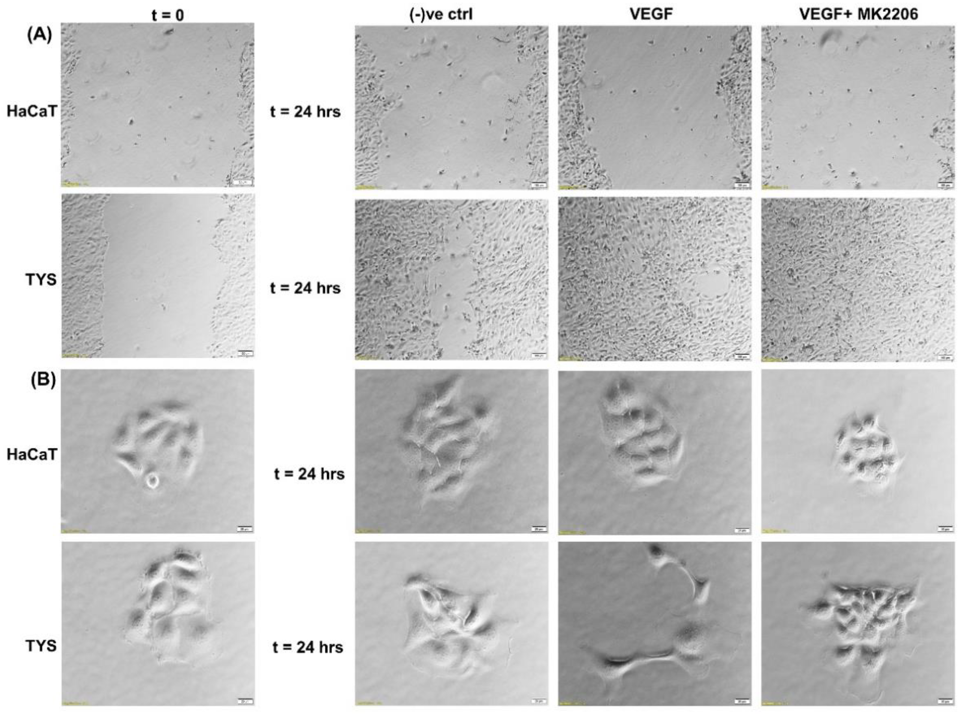 Cancers 14 02606 g006