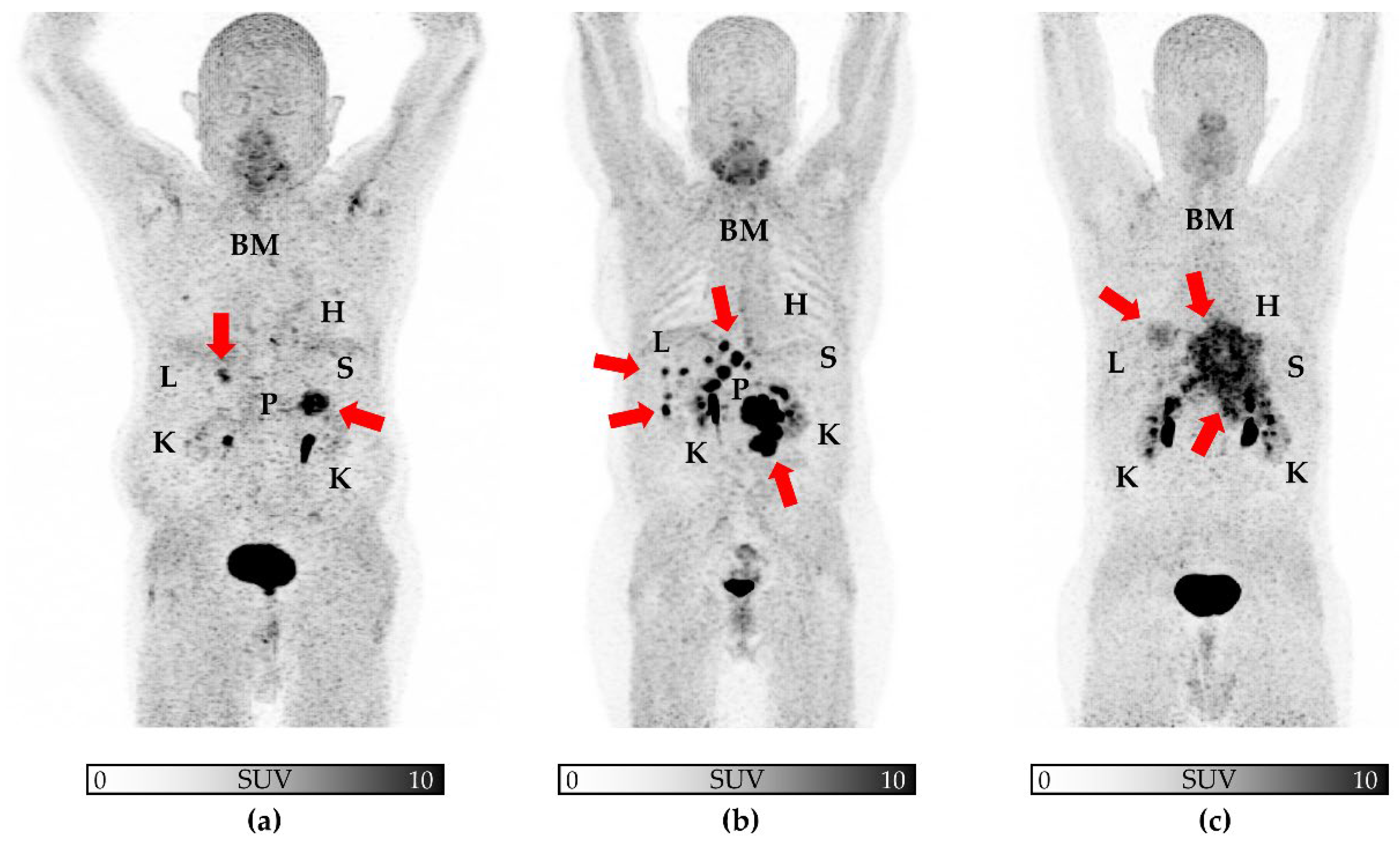 Cancers 14 02609 g004