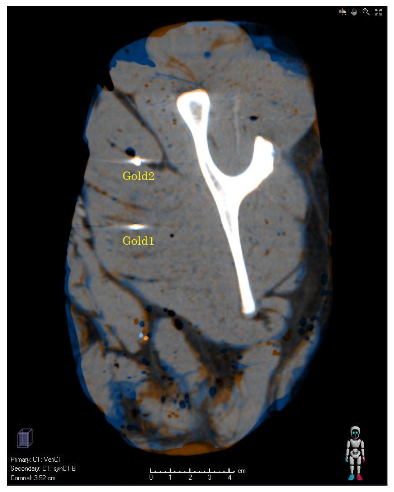 Cancers 14 02616 g002