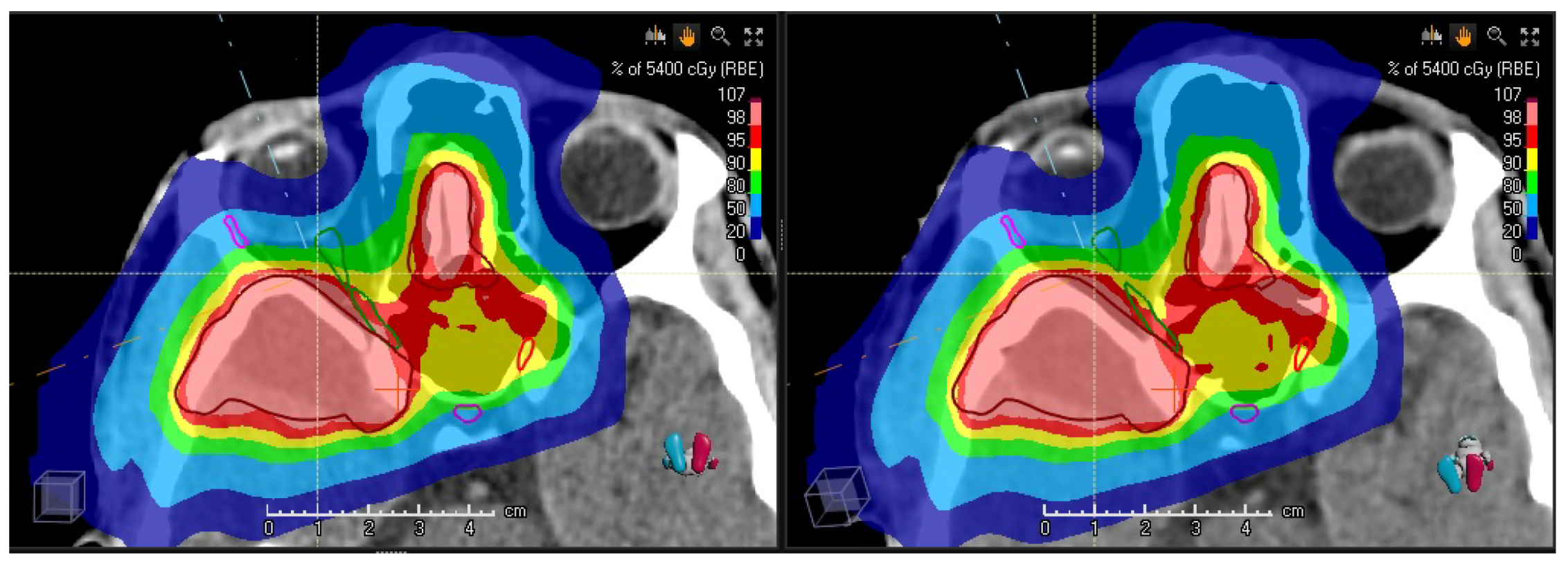 Cancers 14 02616 g004