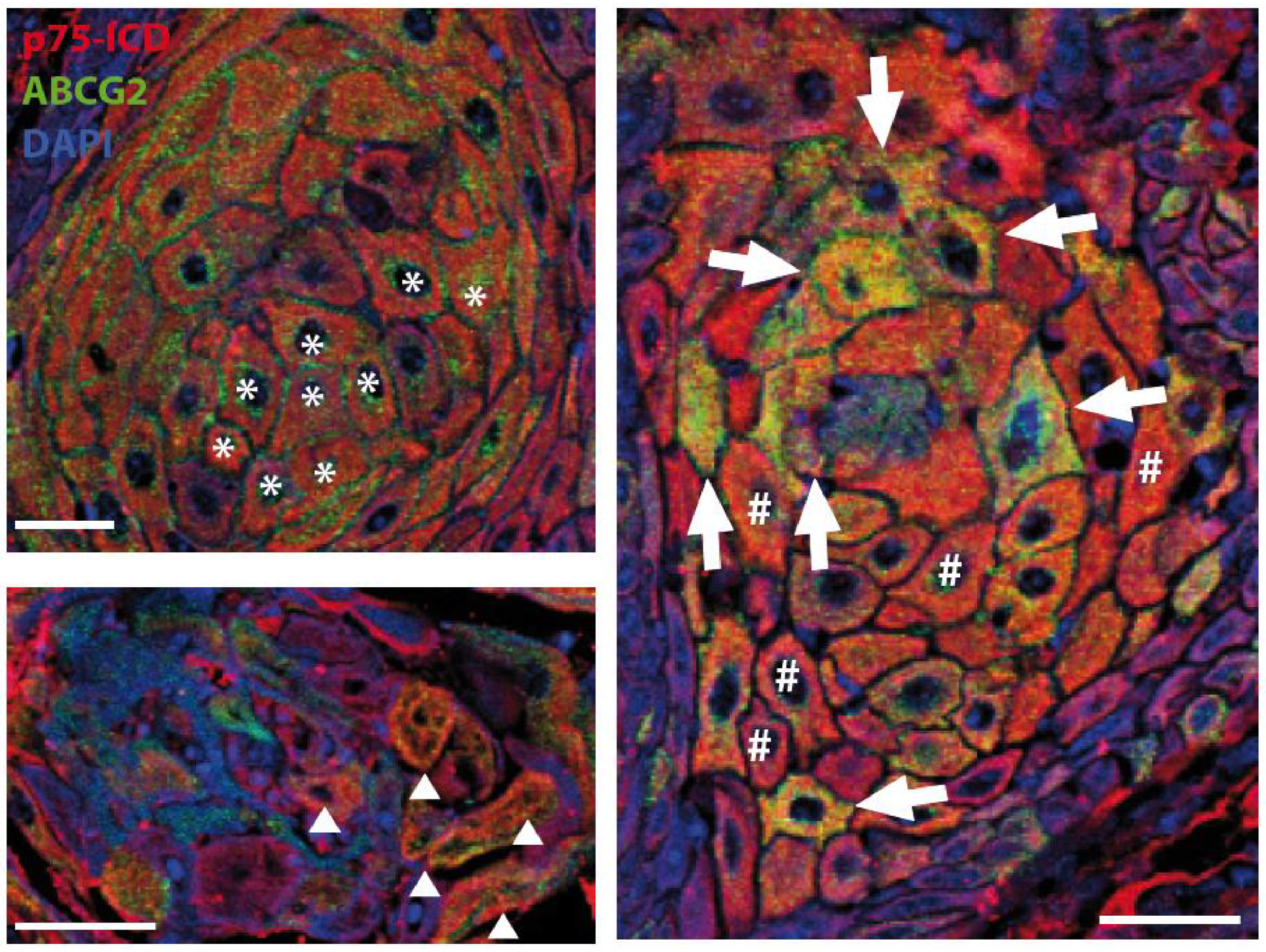 Cancers 14 02622 g004