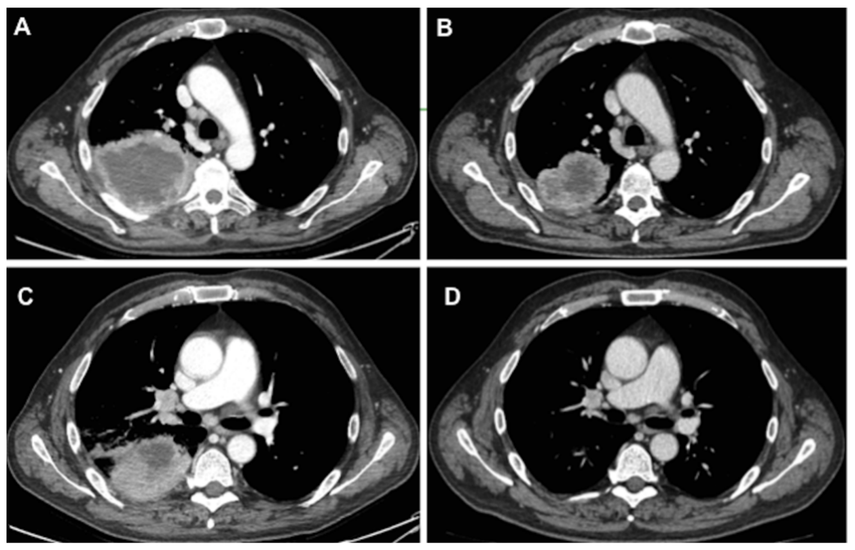 Cancers 14 02661 g001