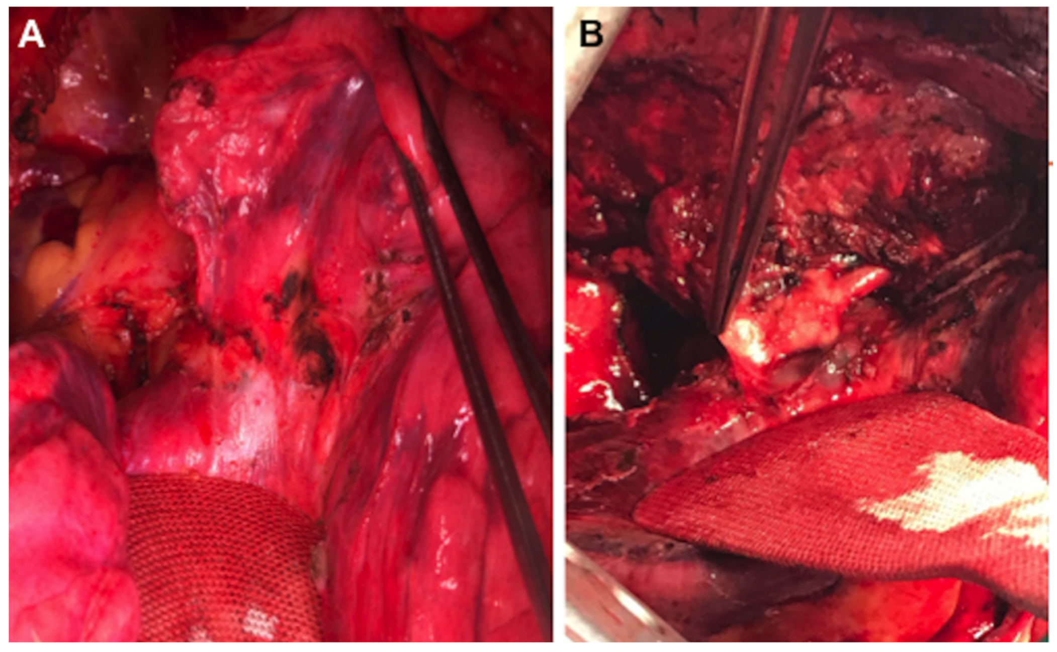 Cancers 14 02661 g005