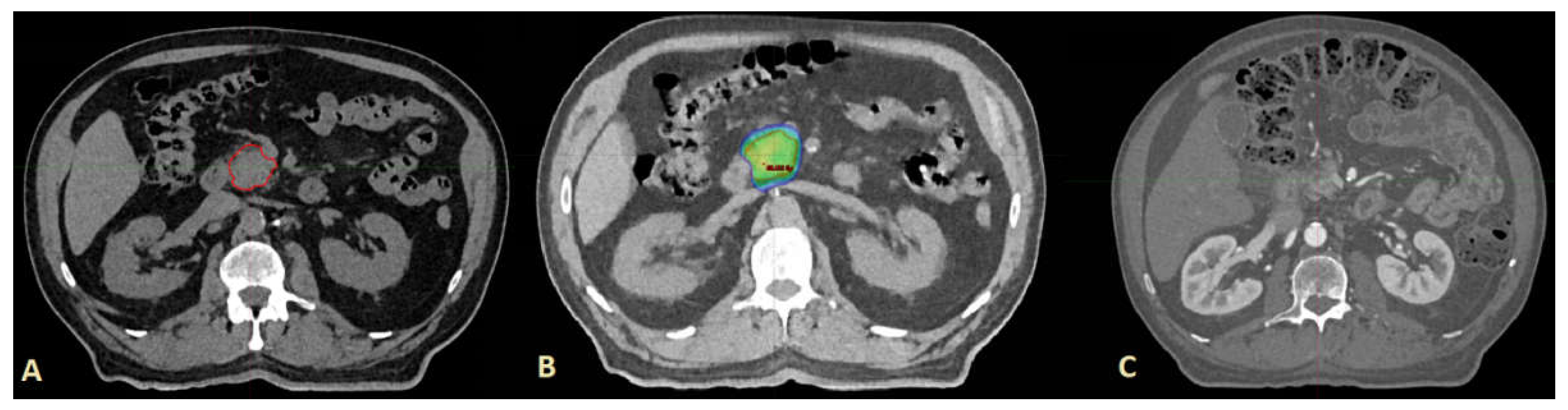 Cancers 14 02688 g006