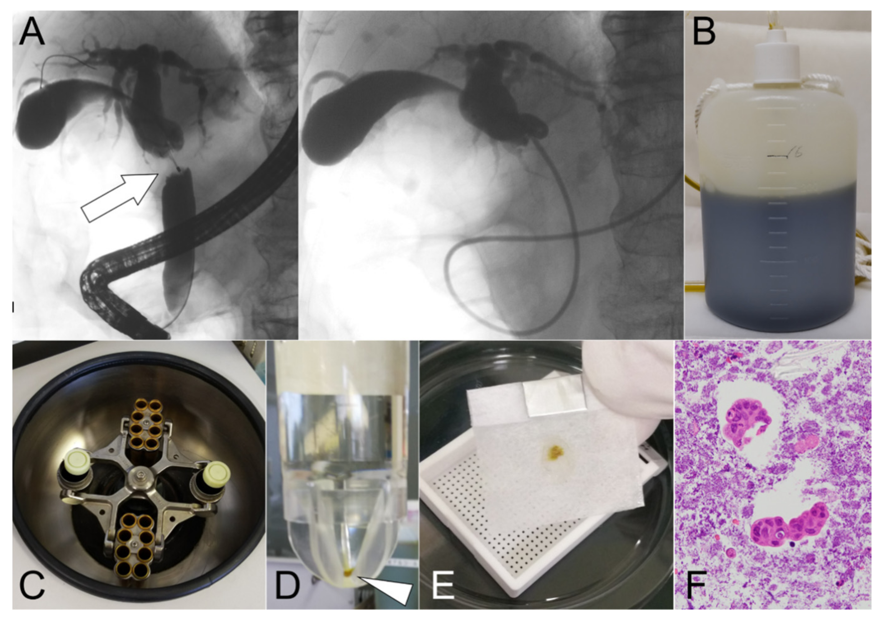 Cancers 14 02701 g002