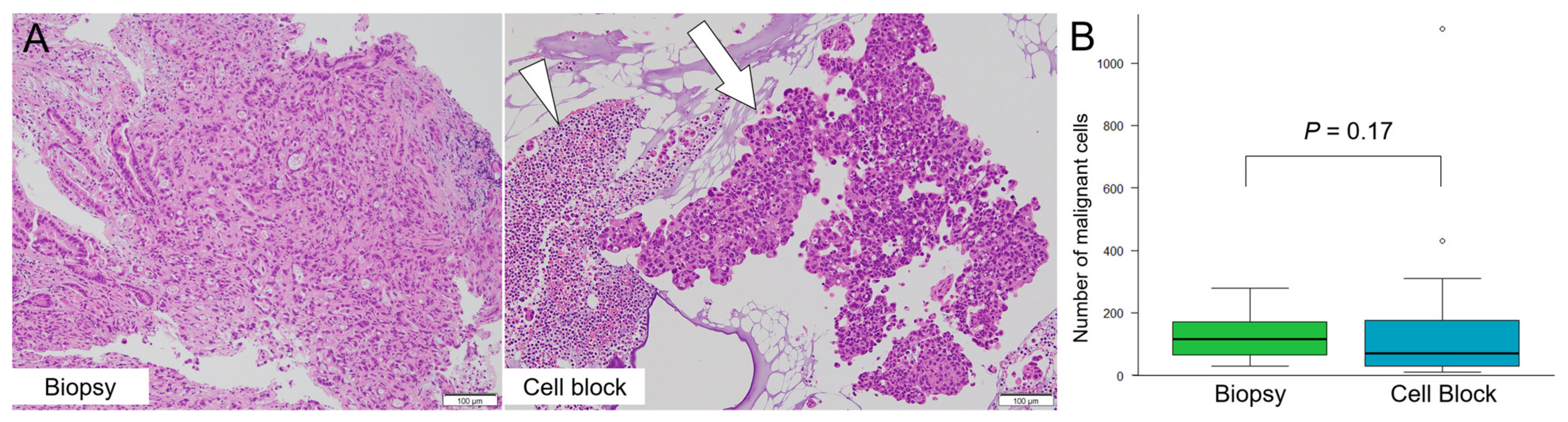 Cancers 14 02701 g004