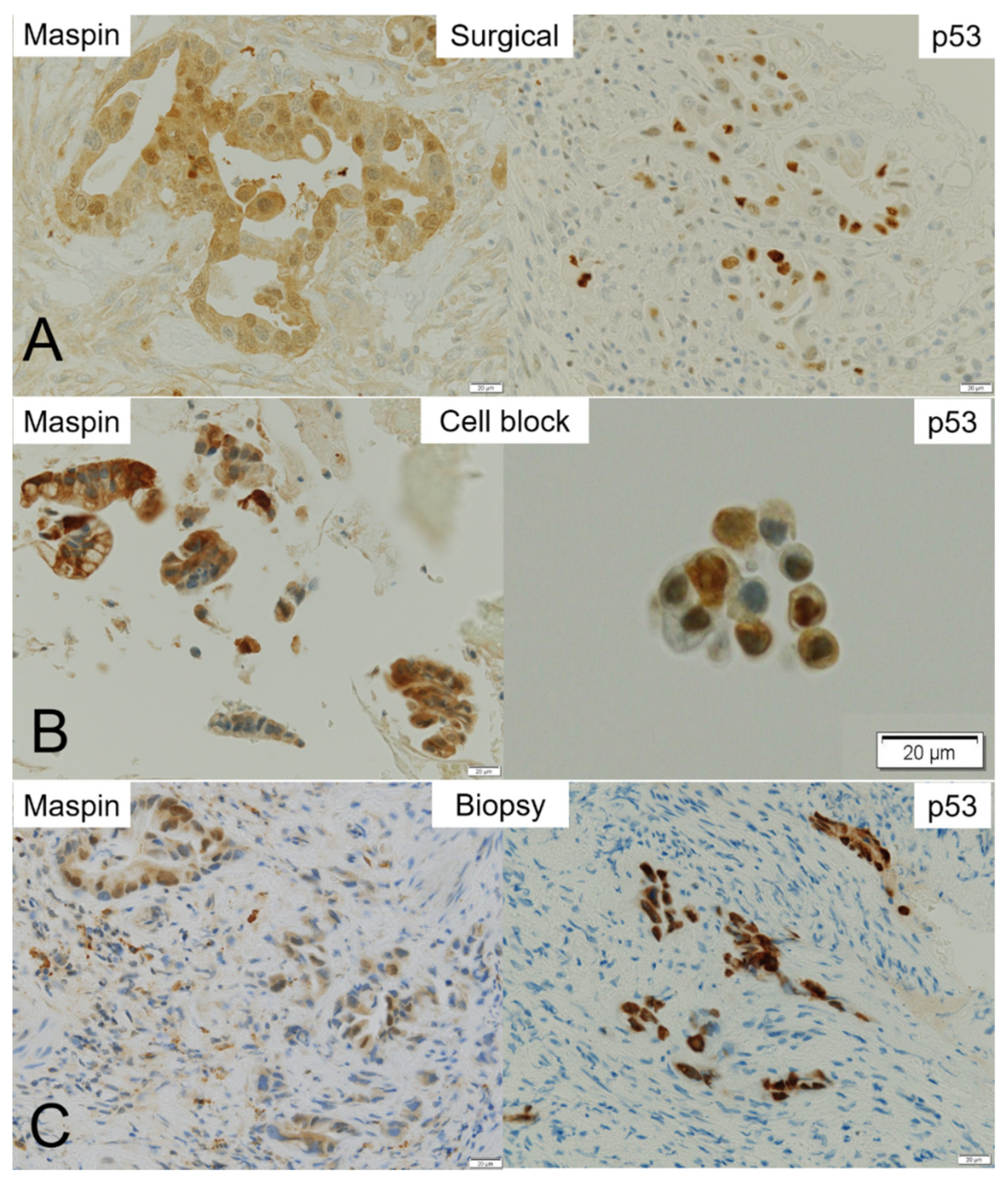 Cancers 14 02701 g005