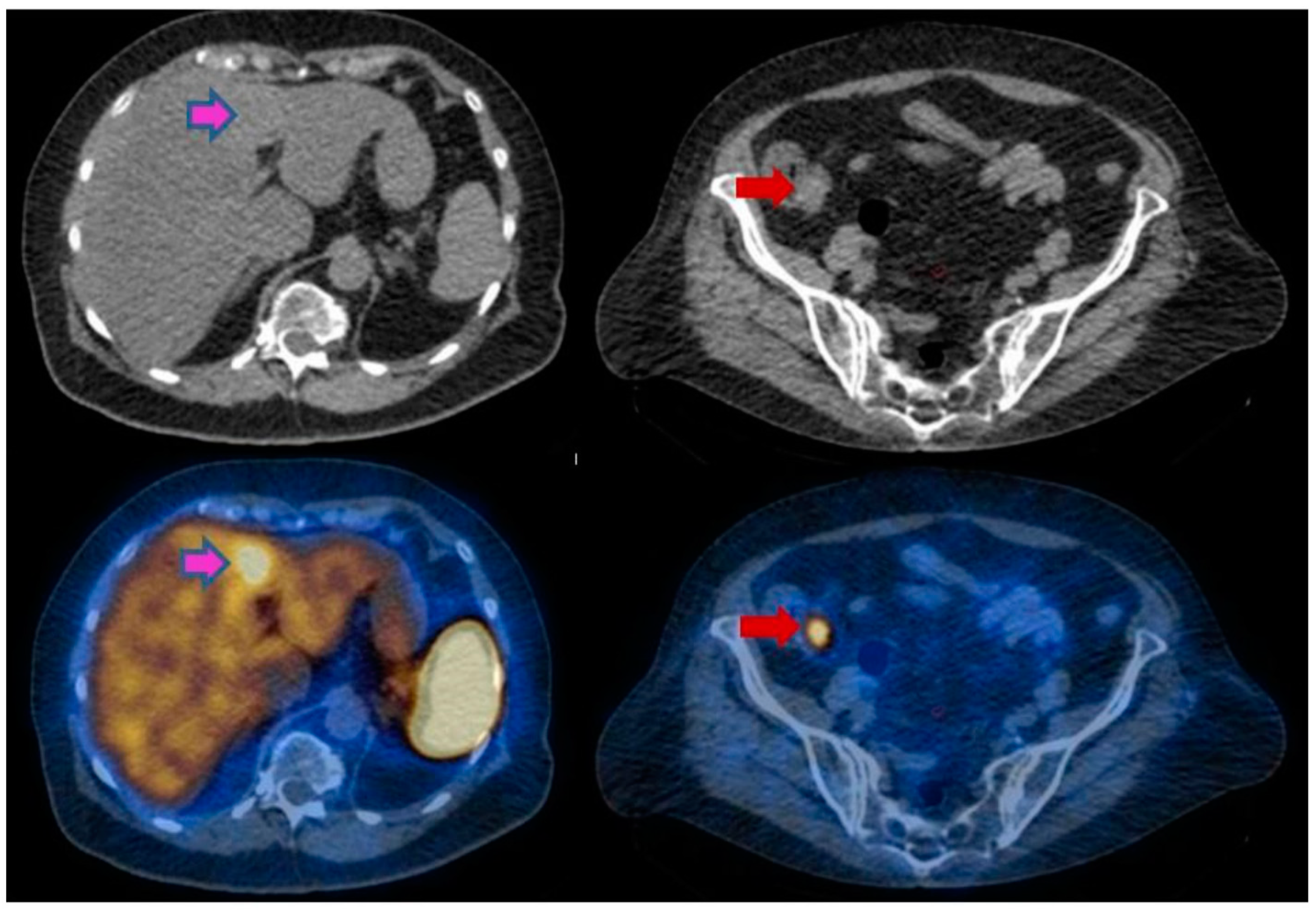 Cancers 14 02725 g001