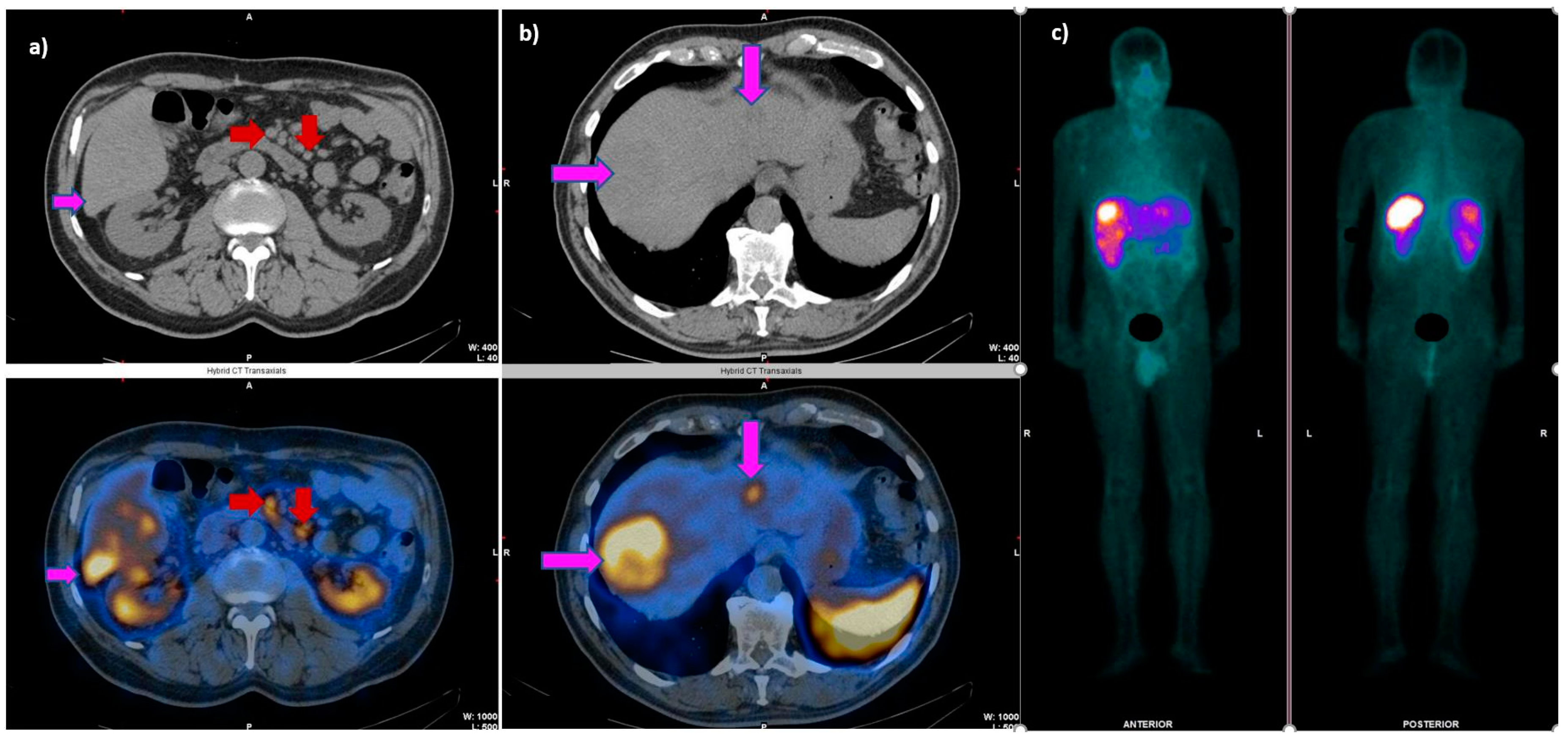 Cancers 14 02725 g002