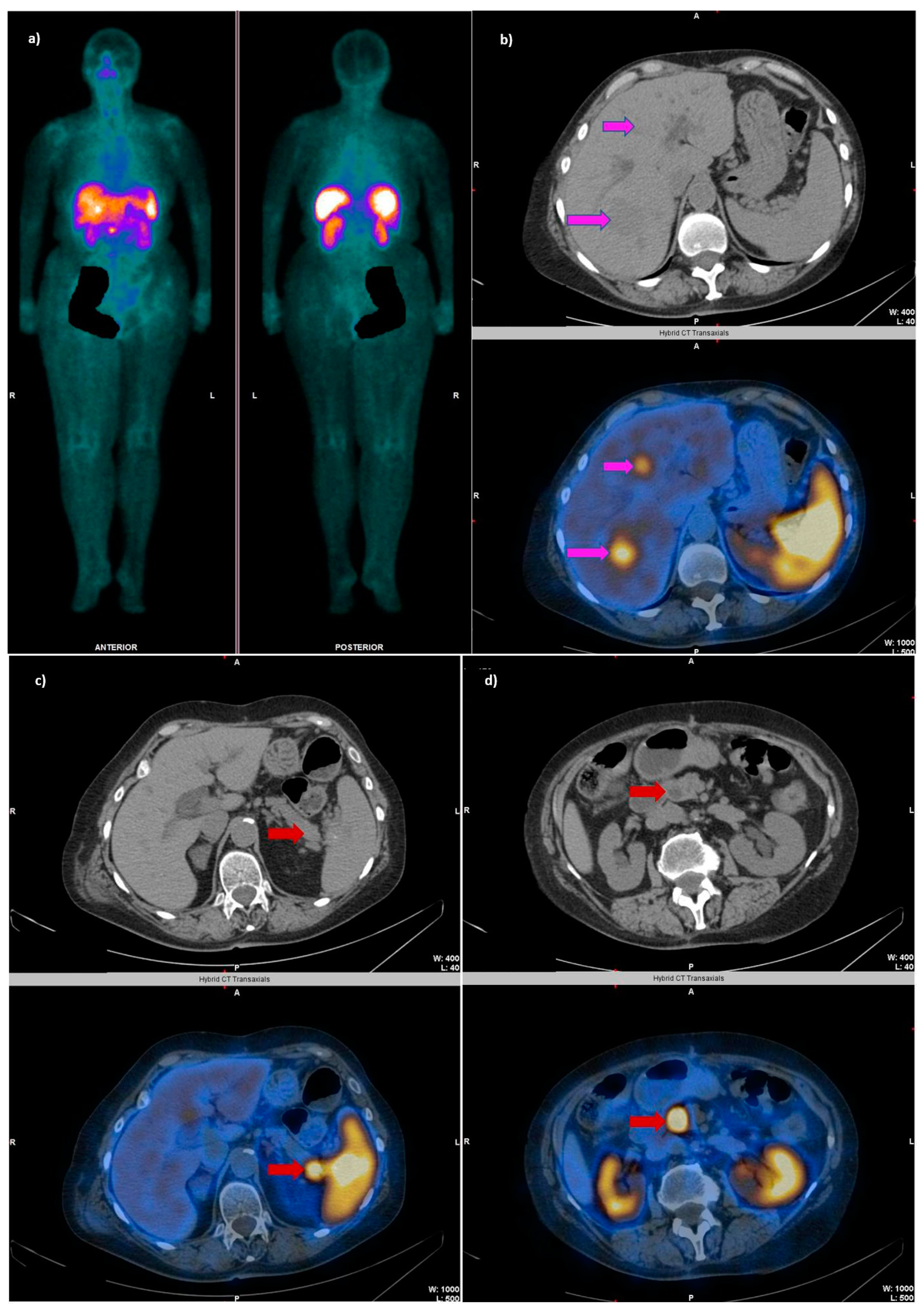 Cancers 14 02725 g003