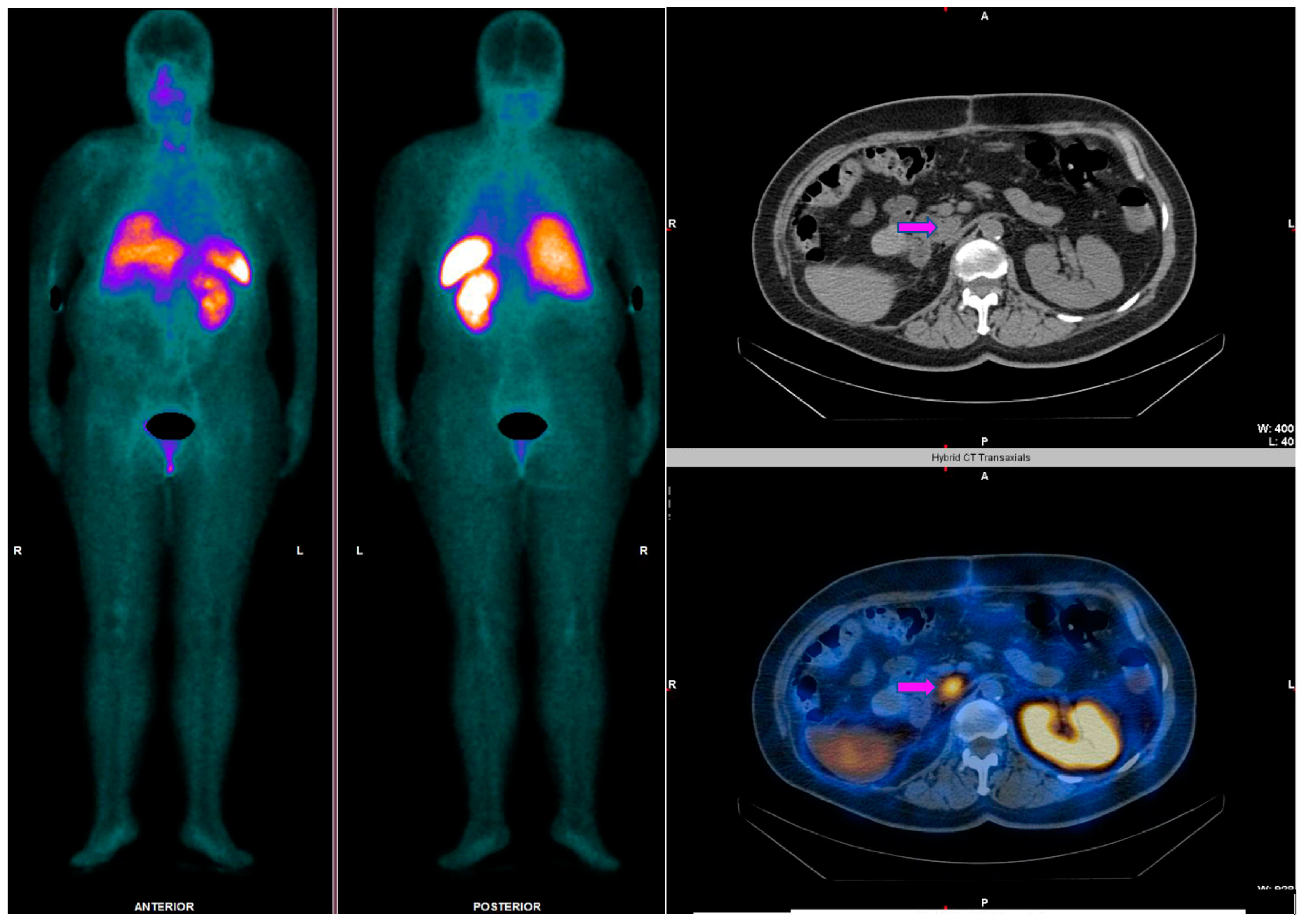 Cancers 14 02725 g004